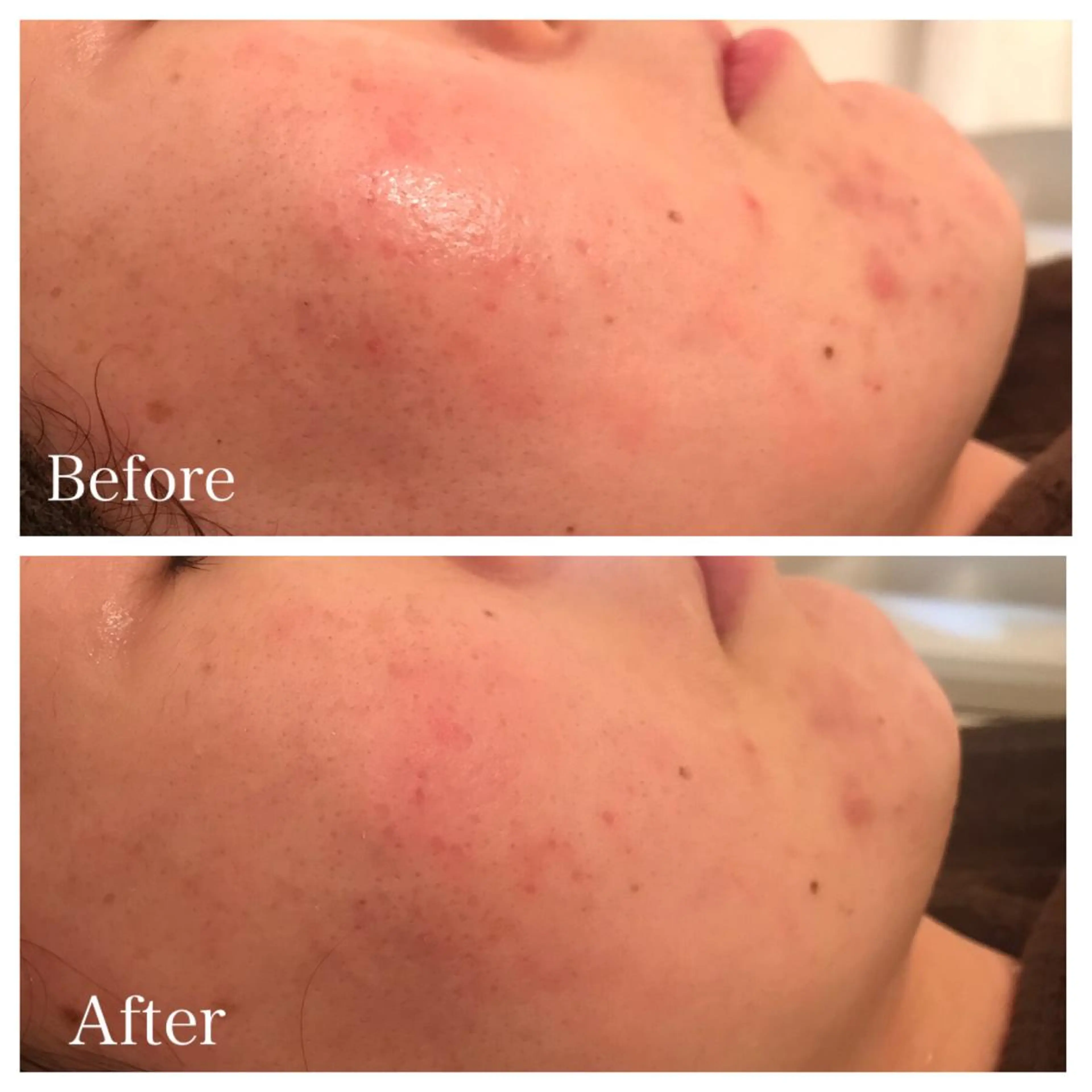 セミロング カラー ネイル マツエク・マツパ エステ リラク ニキビ跡専門サロン Ａｉｎａのエステ・リラクイメージ