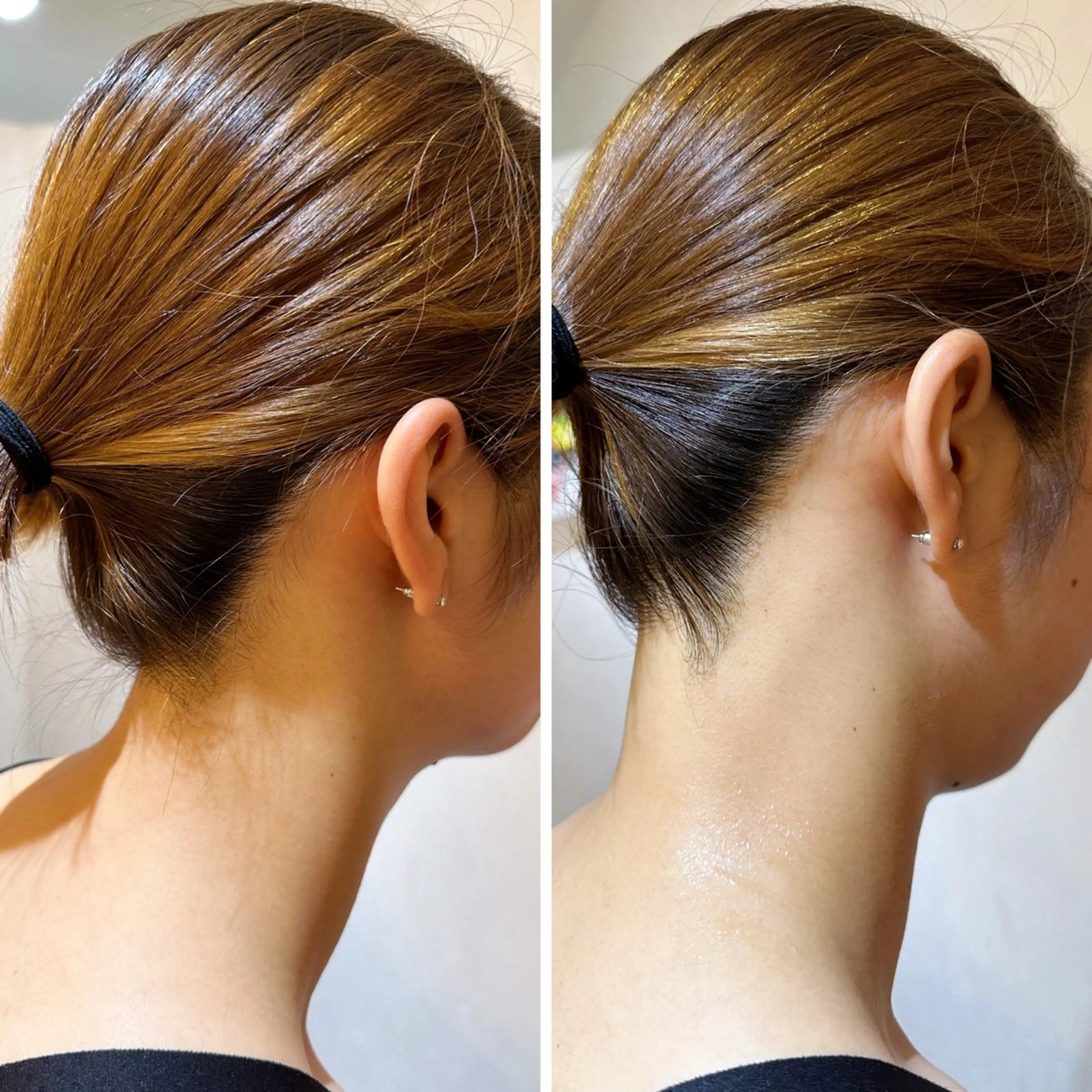 脱毛 うなじ脱毛/美肌脱毛 LABELのエステ・リラクイメージ