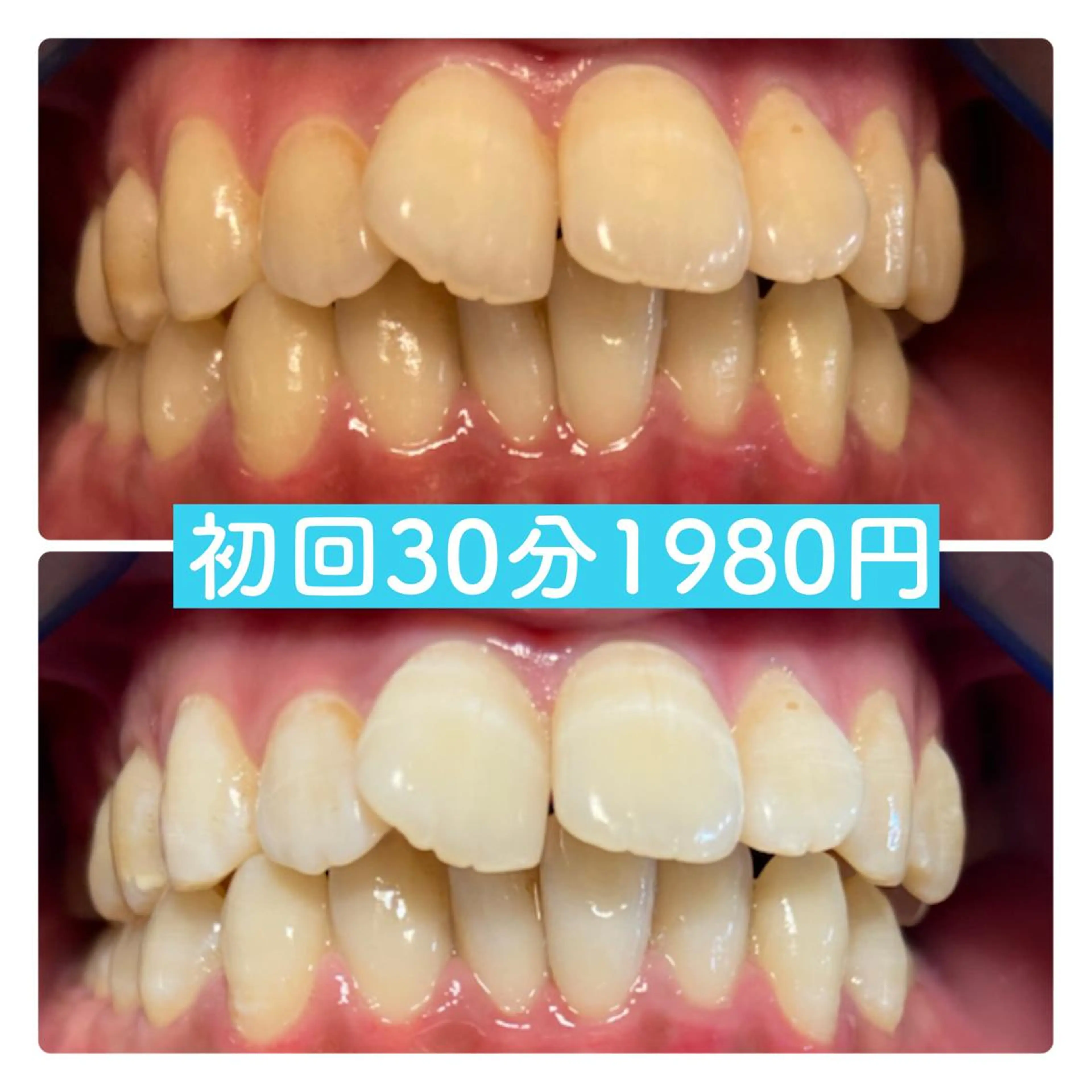 その他 PLATINUM Beauty 横浜店所属・ホワイトニングルーム 横浜店のその他イメージ