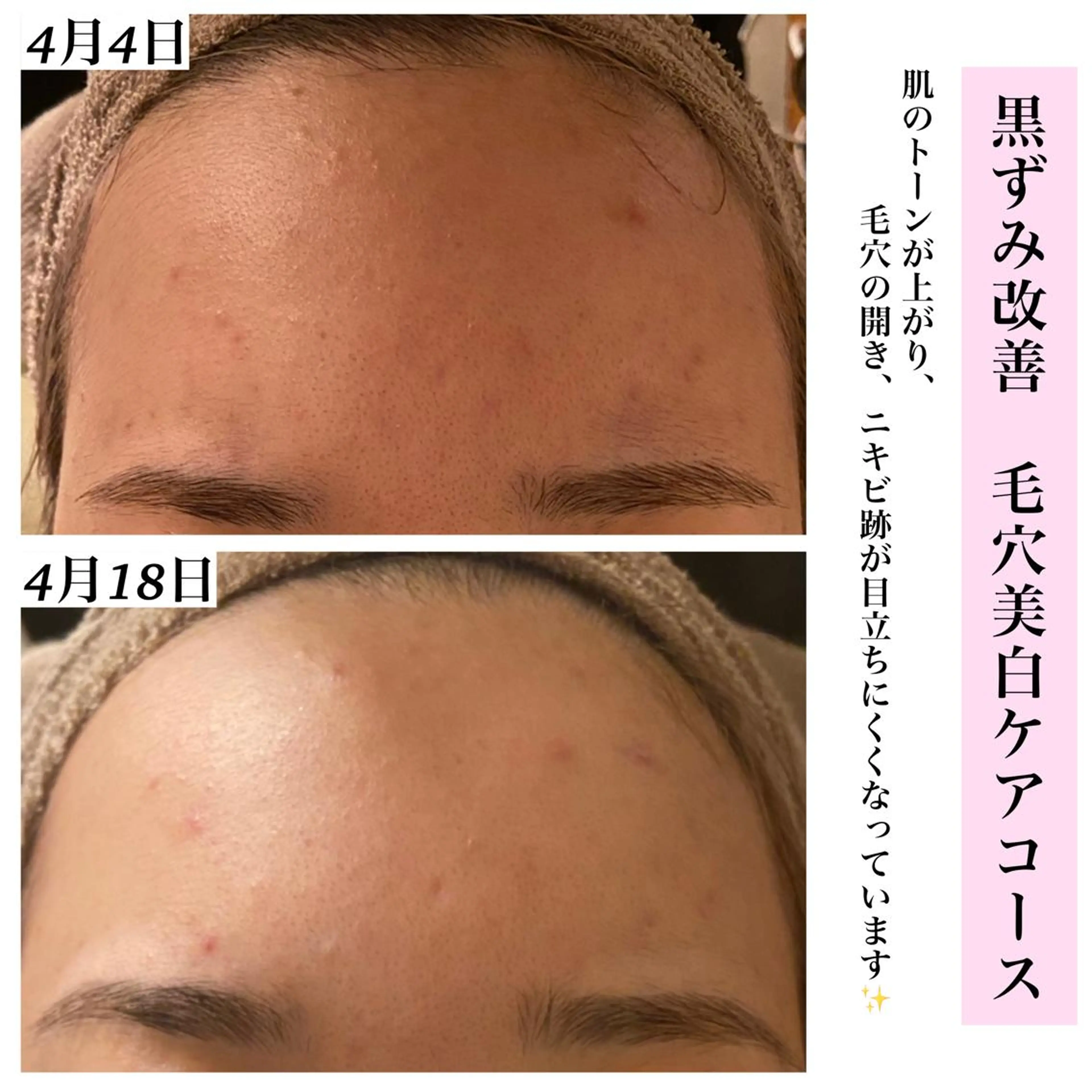 エステ リラク Bellesthe （ベルエステ）のエステ・リラクイメージ