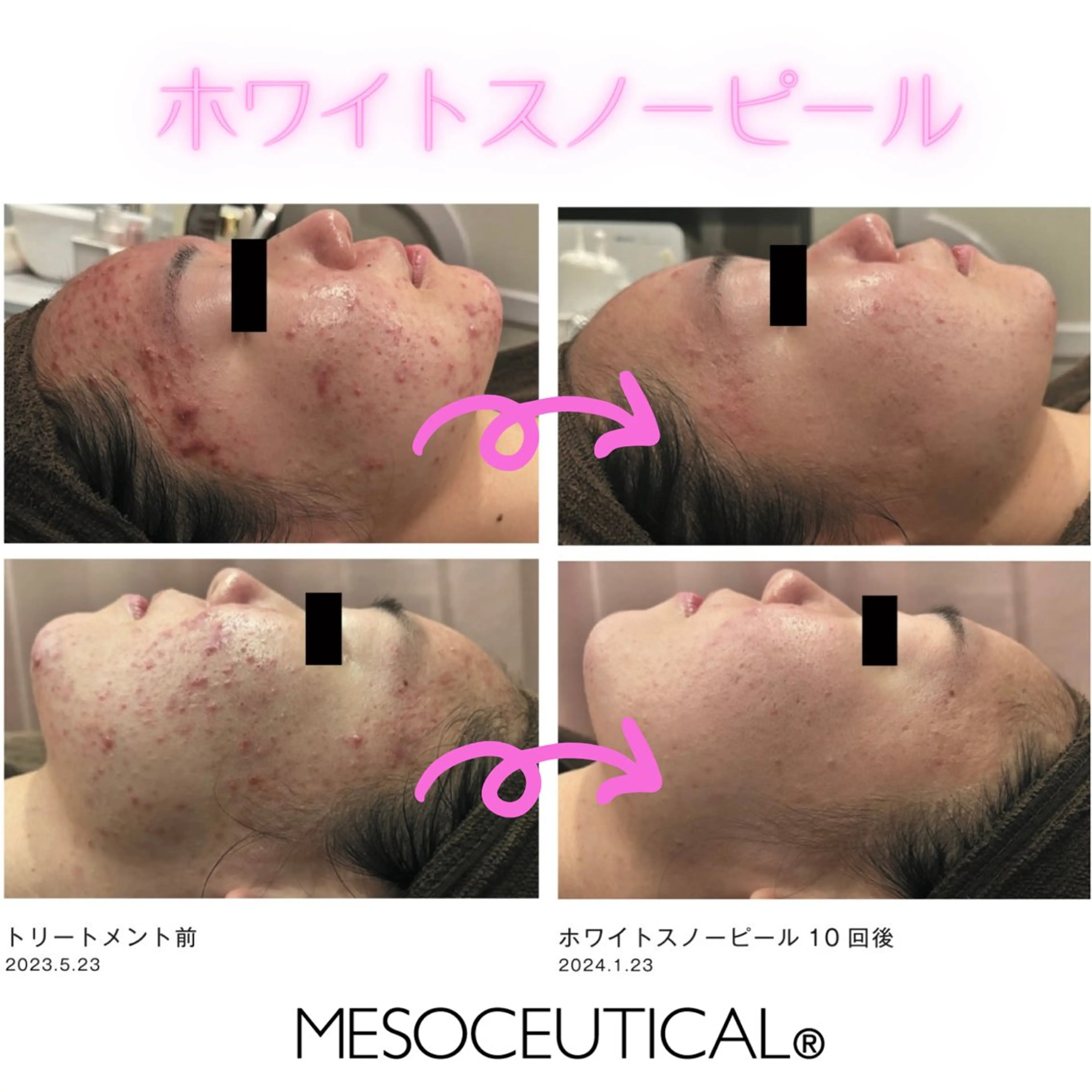 アドミーロ 💎CHIKA💎のエステ・リラクイメージ