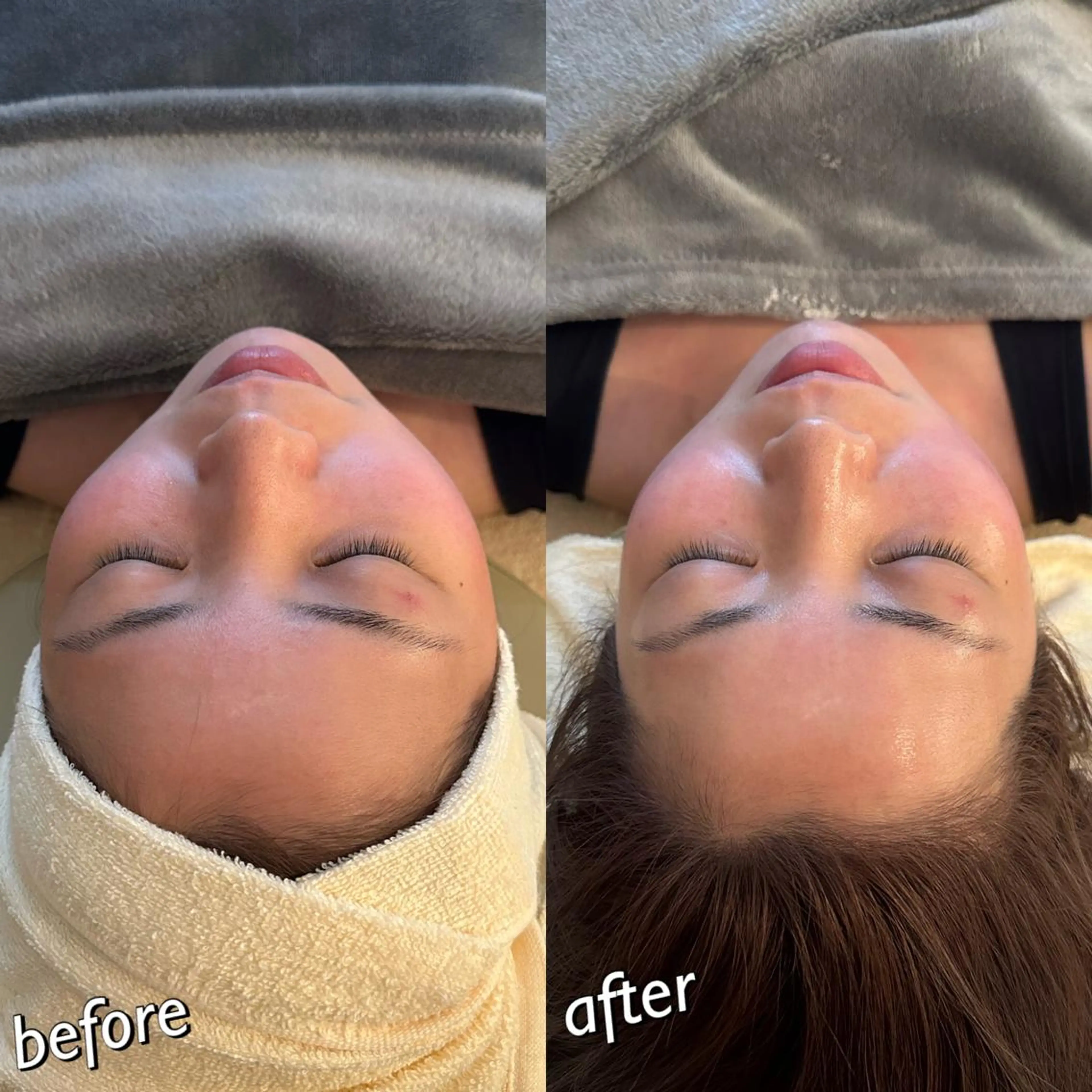 うなじ脱毛/美肌脱毛 LABELのエステ・リラクイメージ