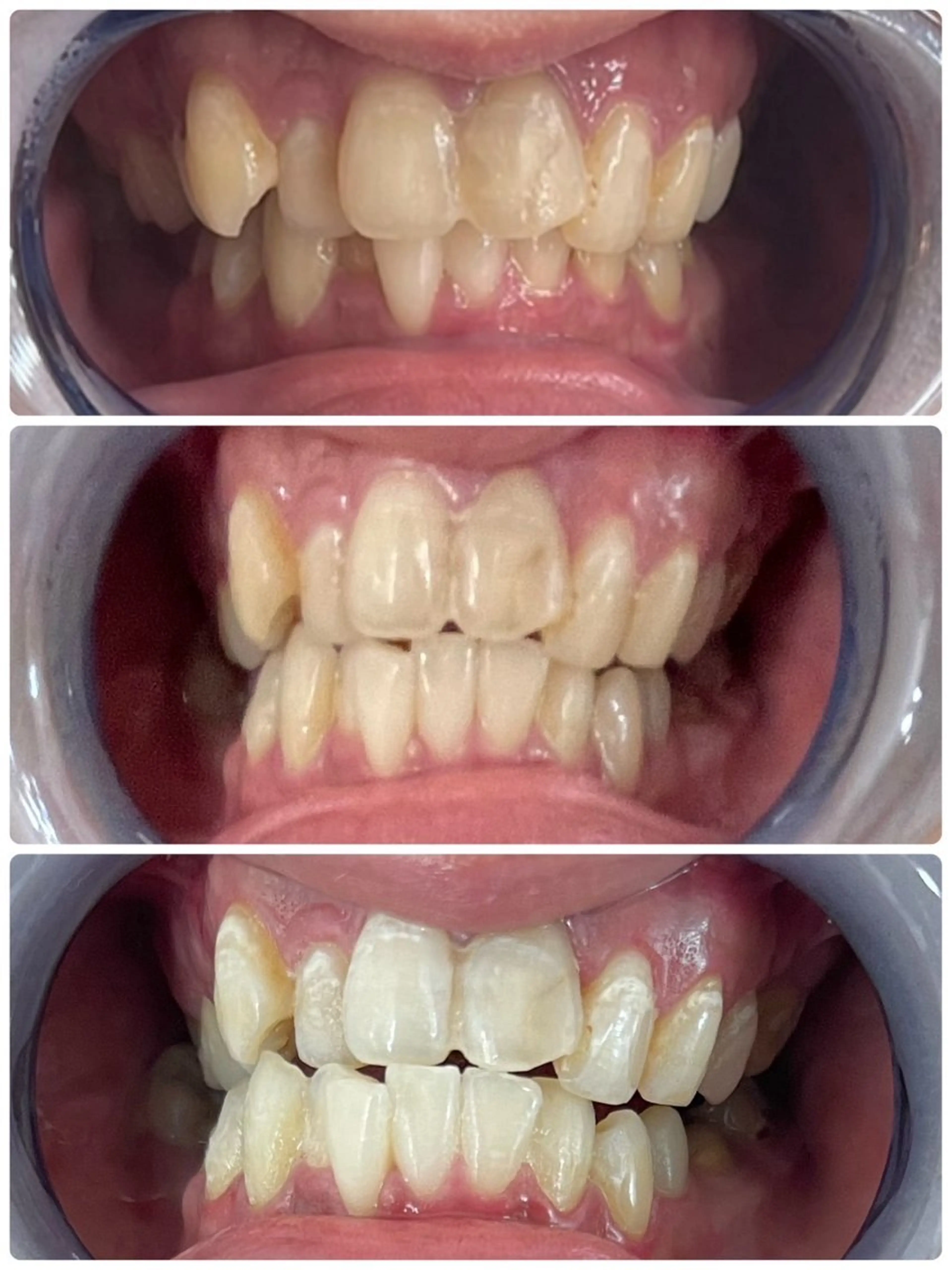 セルフホワイトニング エクシア徳島店マユのその他イメージ
