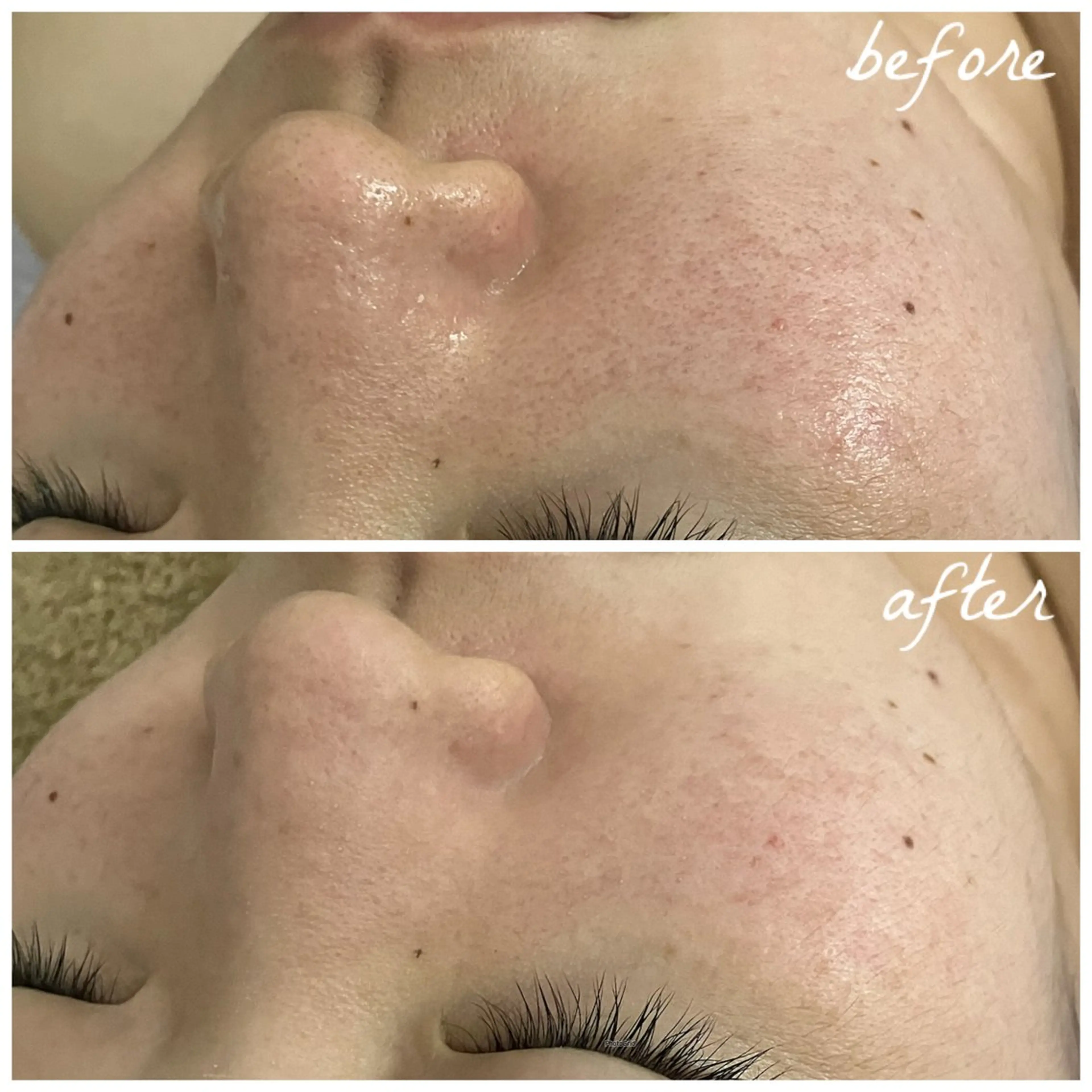 メンズ メナード岐阜茜部 杉浦のエステ・リラクイメージ