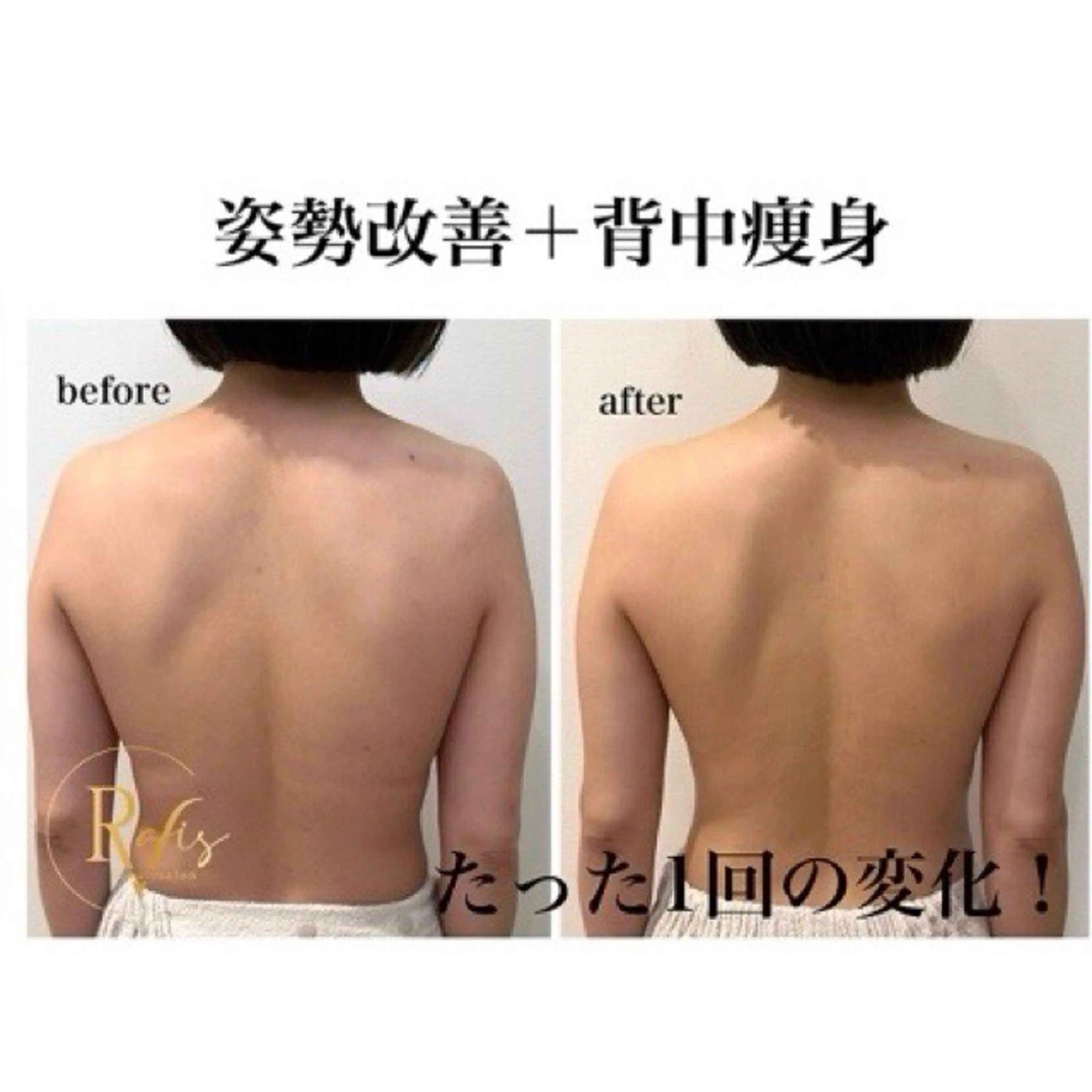 beautysalon RAVIS所属・東大阪/韓国肌管理/ 痩身バスト専門店のエステ・リラクイメージ