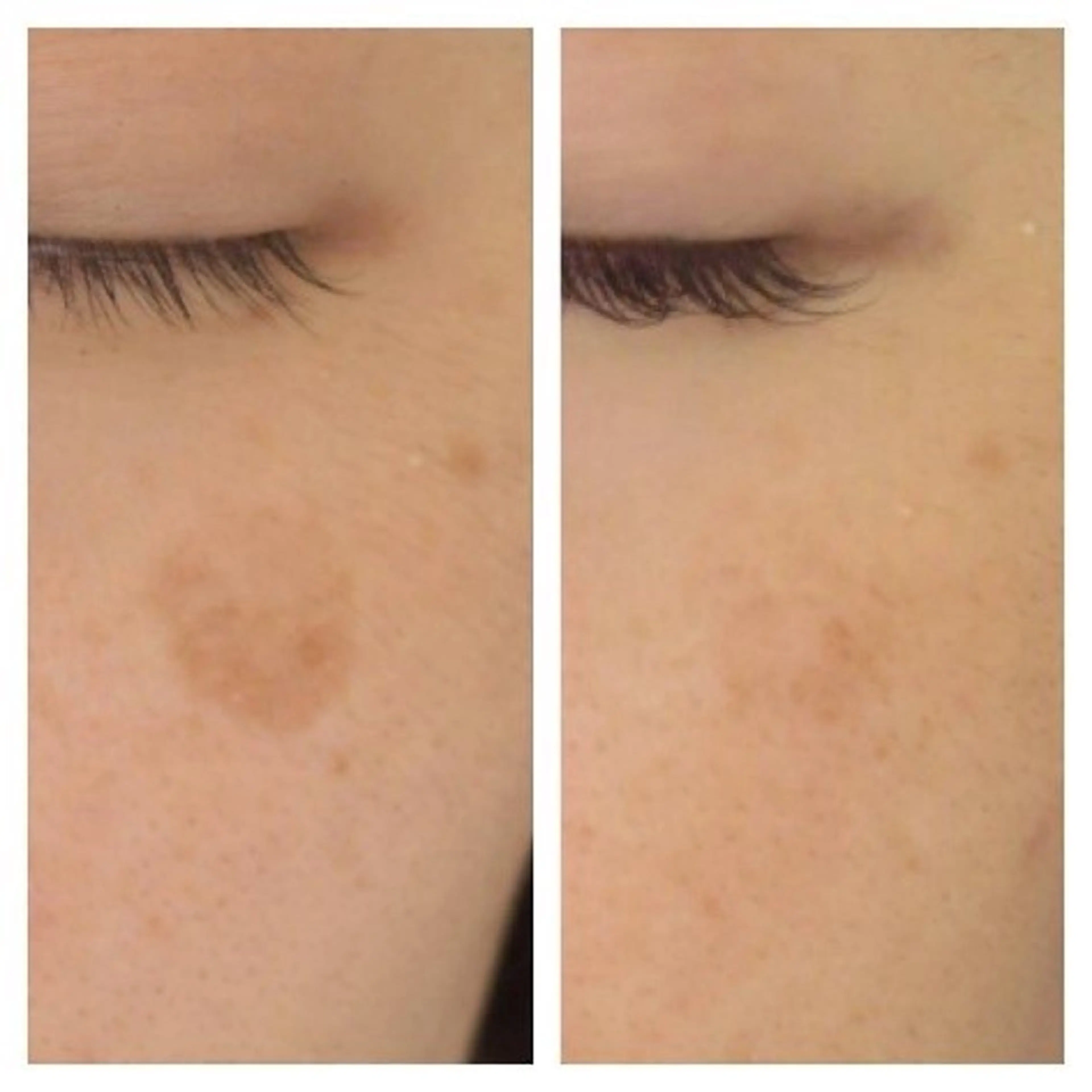 M. lisyelのエステ・リラクイメージ