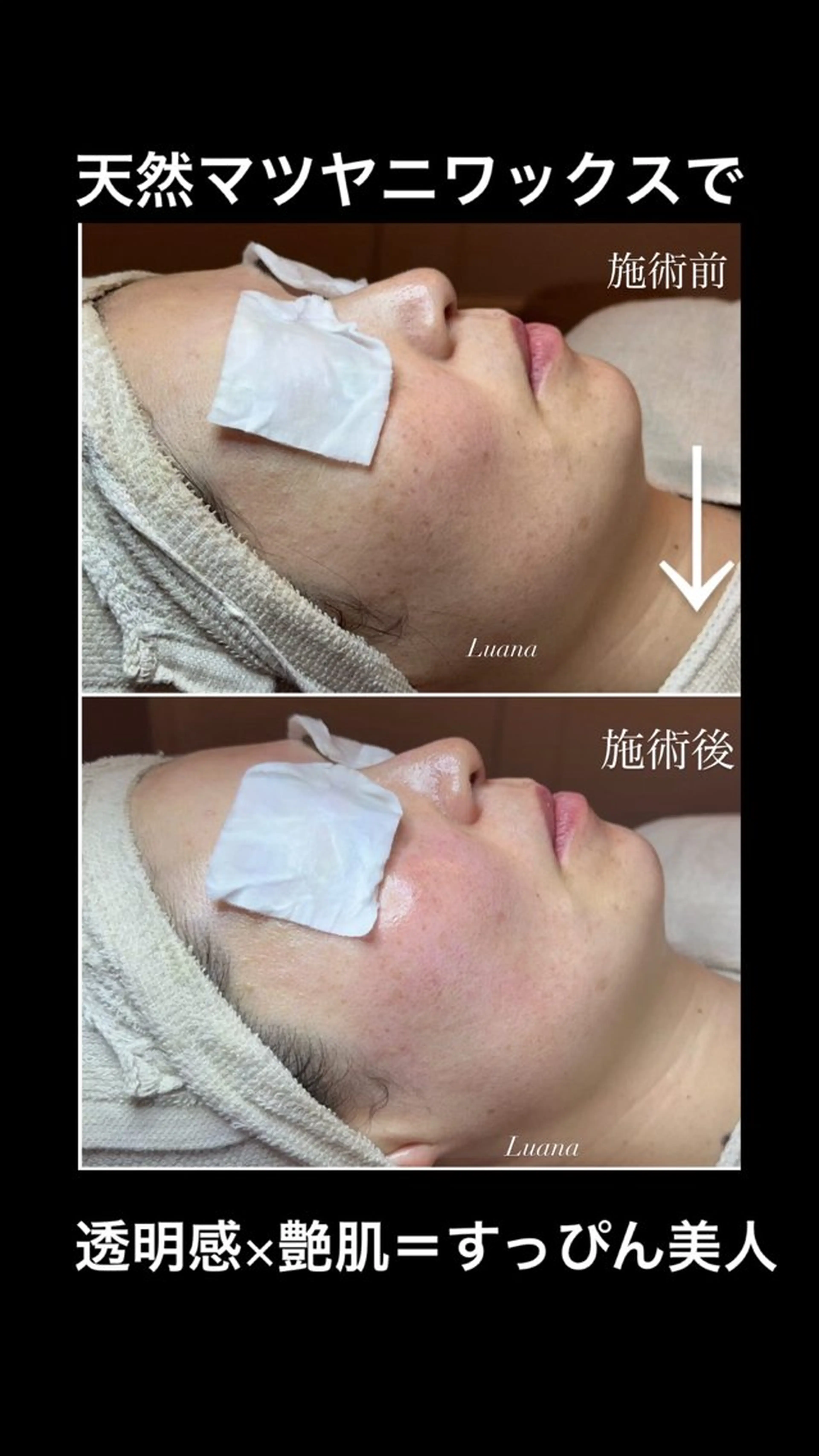 マツヤニWax専門/ 岸和田/Luanaのエステ・リラクイメージ