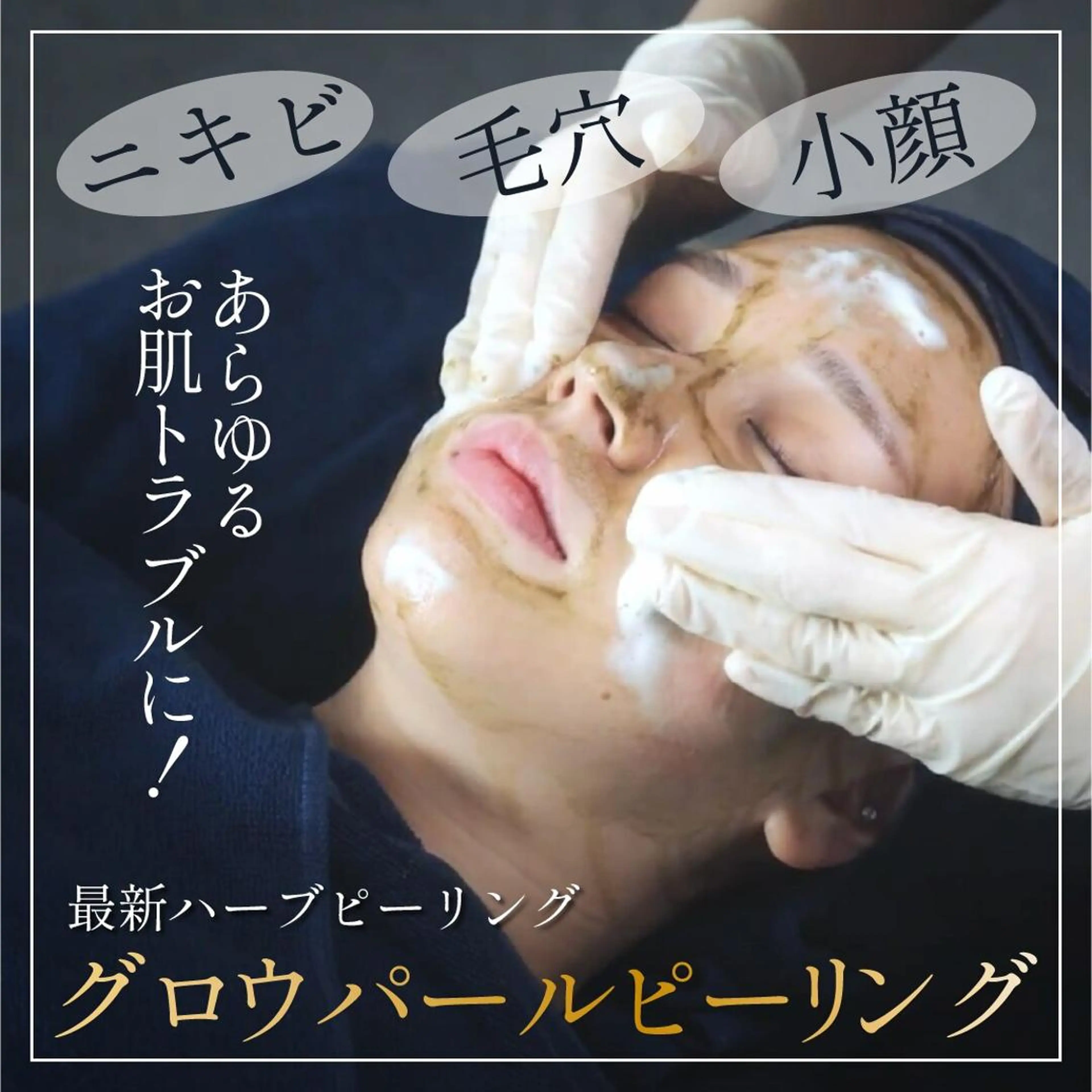 韓国クリニックから導入★【毛穴たるみニキビニキビ跡ケア/小顔にも◎】グロウパールハーブピーリングの写真