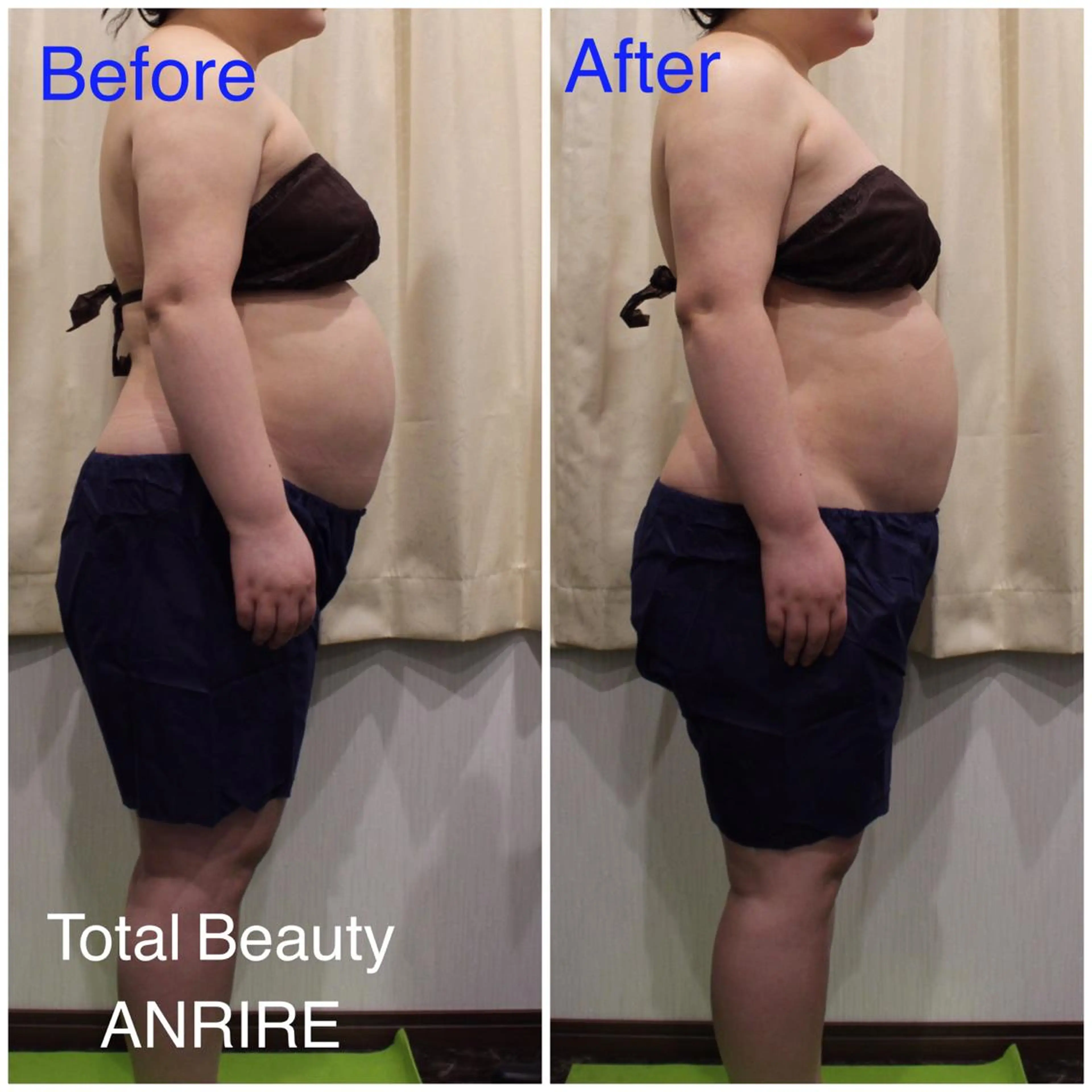 ANRIRE (アンリール)のエステ・リラクイメージ