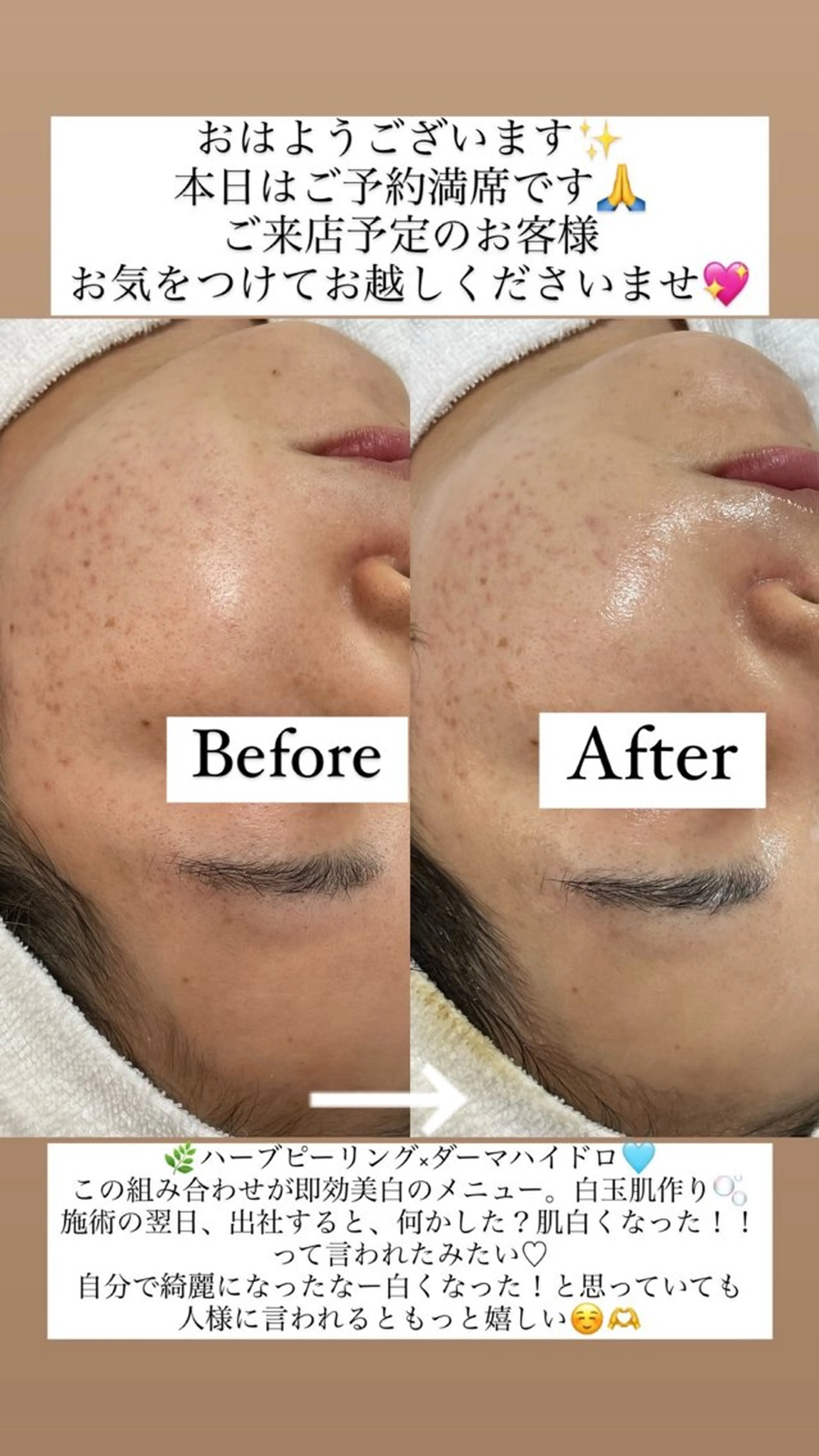 private salon éclat所属・ニキビ・毛穴専門 éclat/エクラのエステ・リラクイメージ