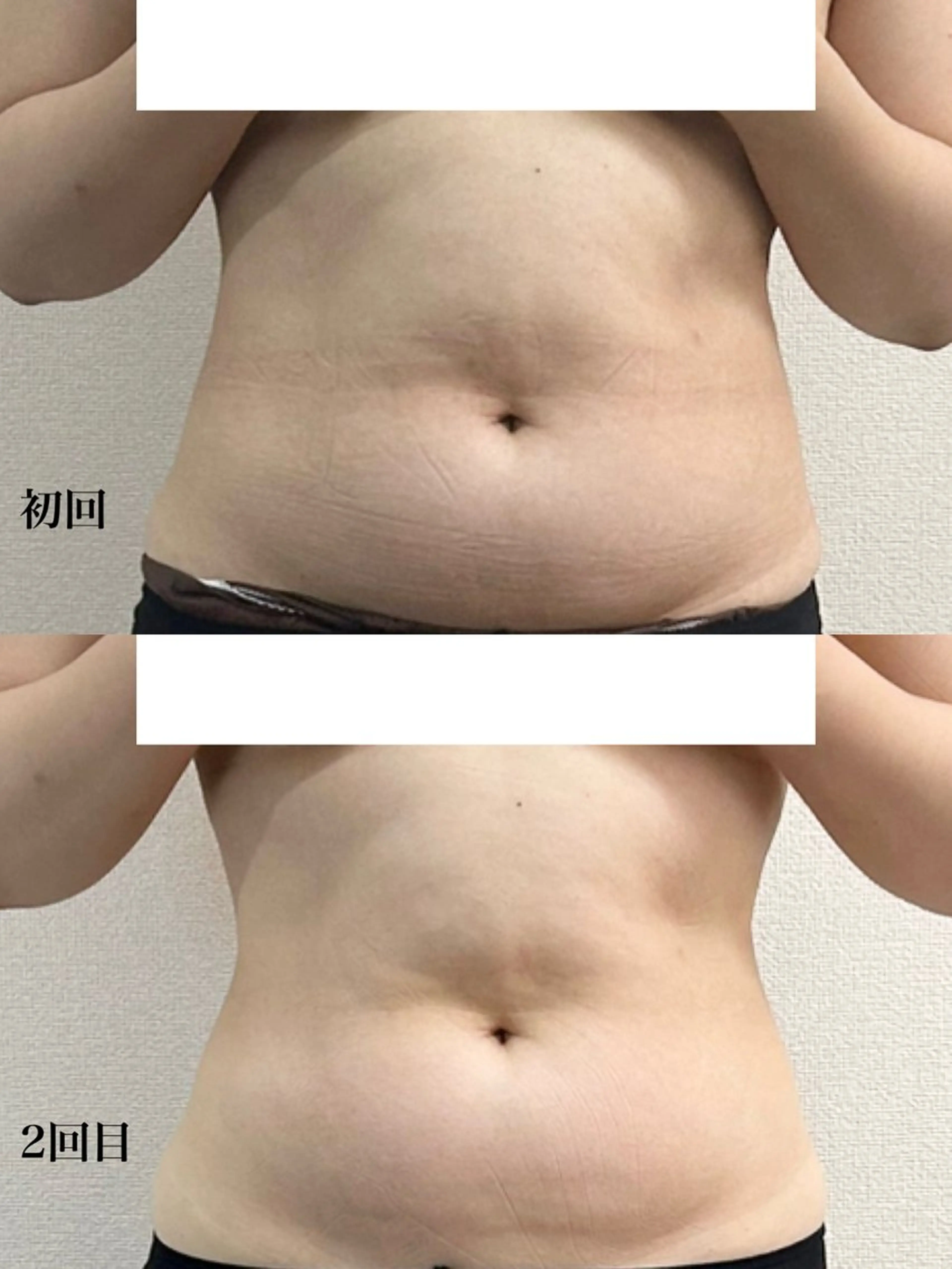 柔軟性＆血流促進！【溜めない体へ】全身リンパデトックス身90分コース　¥11,000の写真