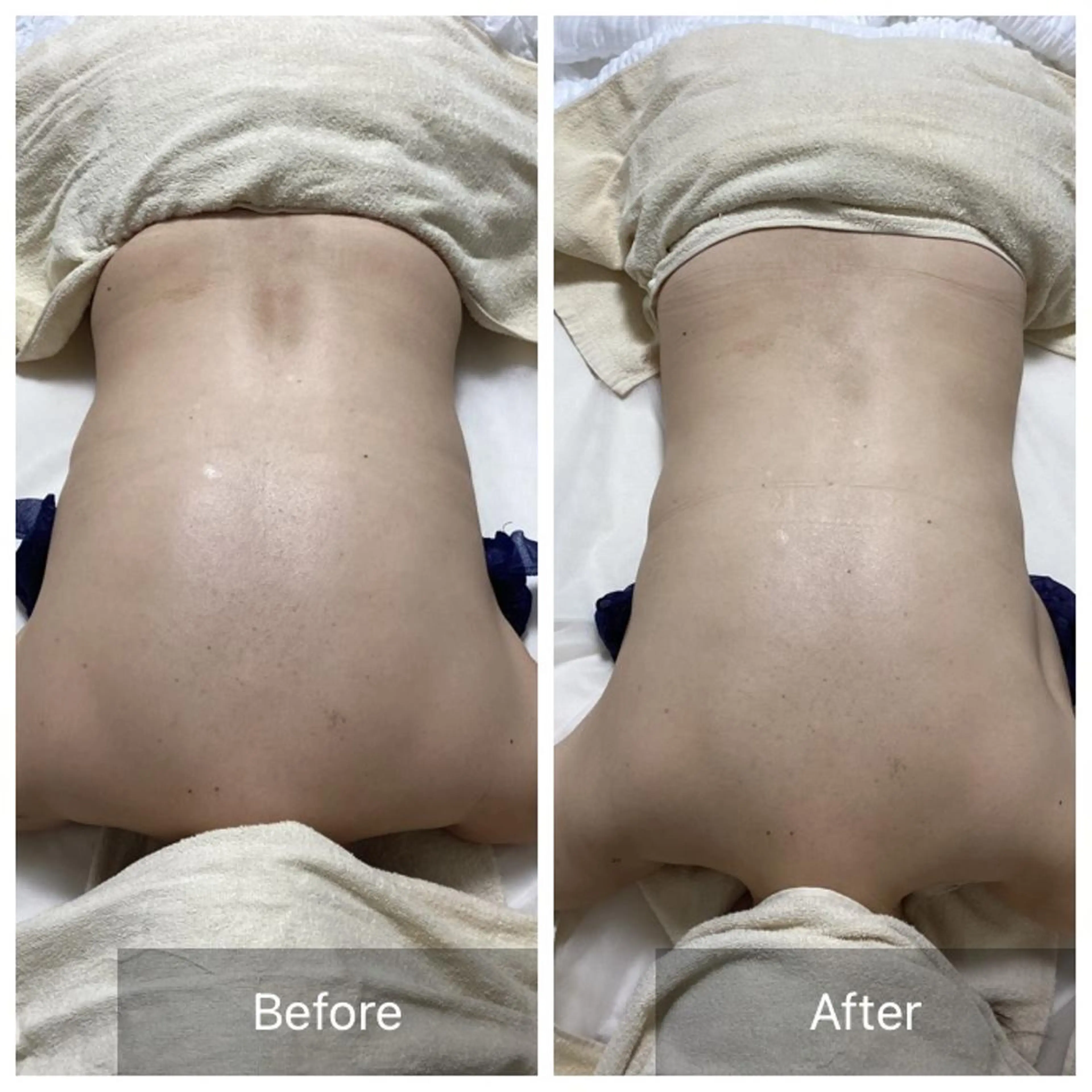 エステ Dahlia Moriのエステ・リラクイメージ