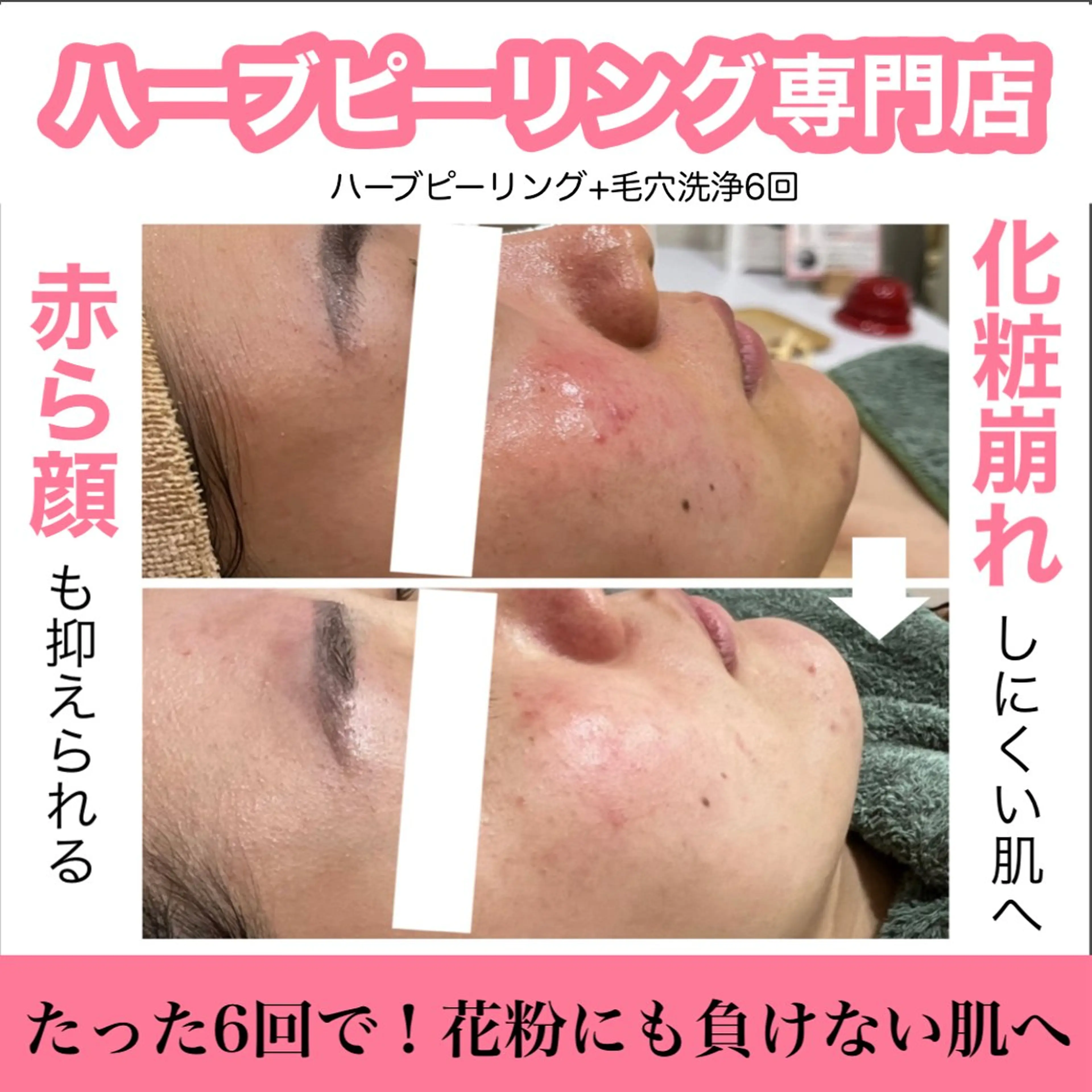 ハーブピーリング専門 muro.のエステ・リラクイメージ