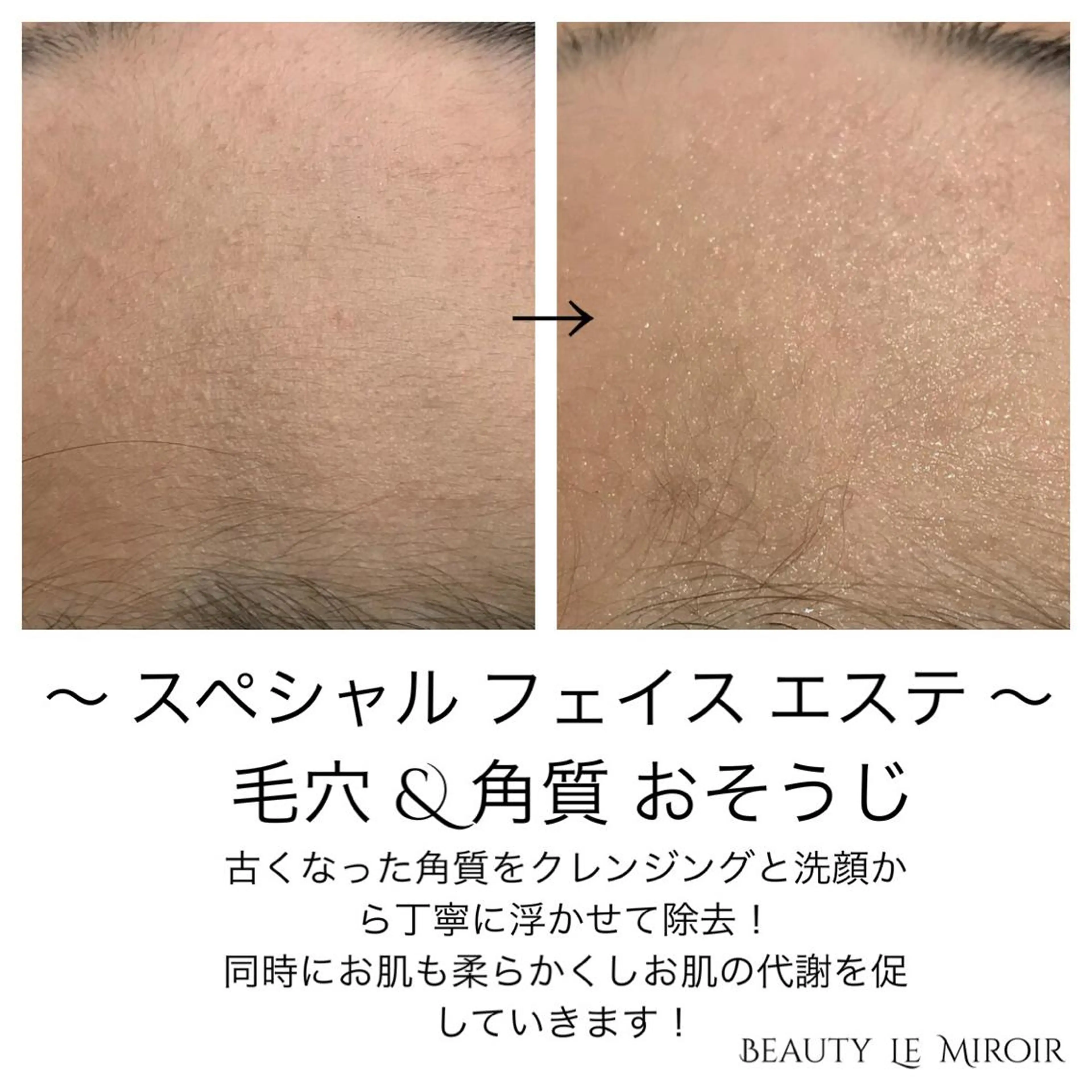 ビューティー ミロワールのエステ・リラクイメージ