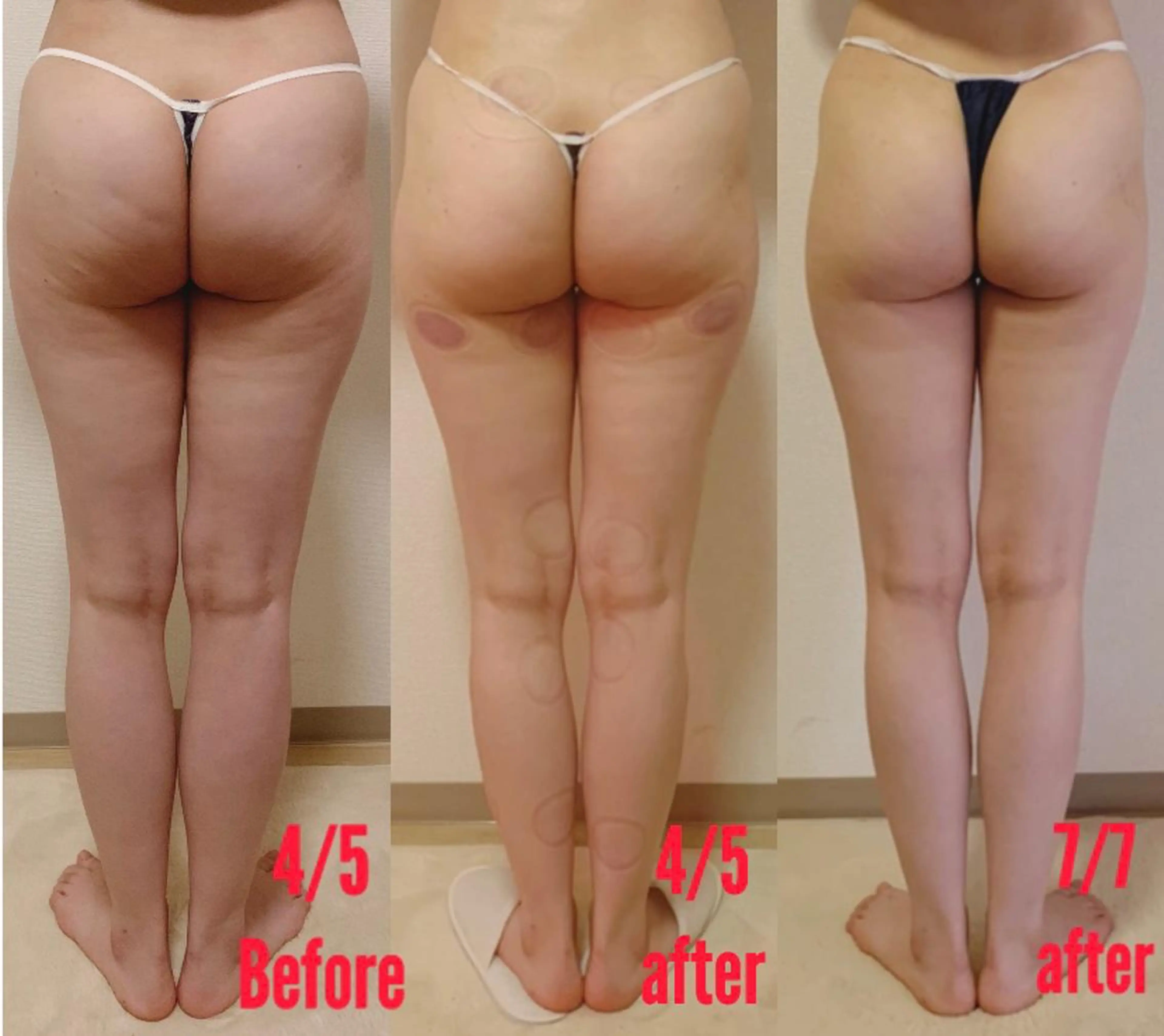 a  room salonのエステ・リラクイメージ