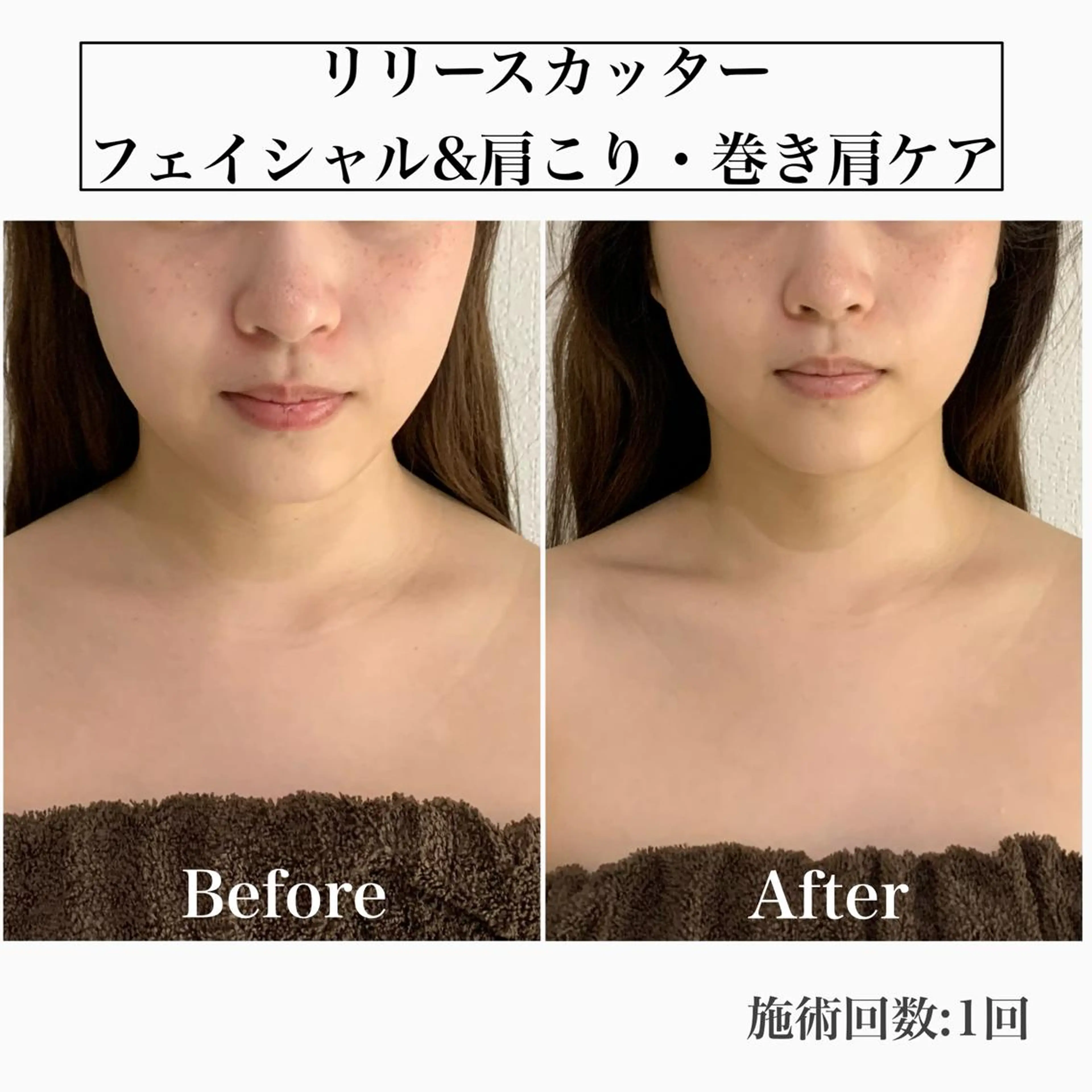 堀之内宏次 ［美容鍼灸師］のエステ・リラクイメージ