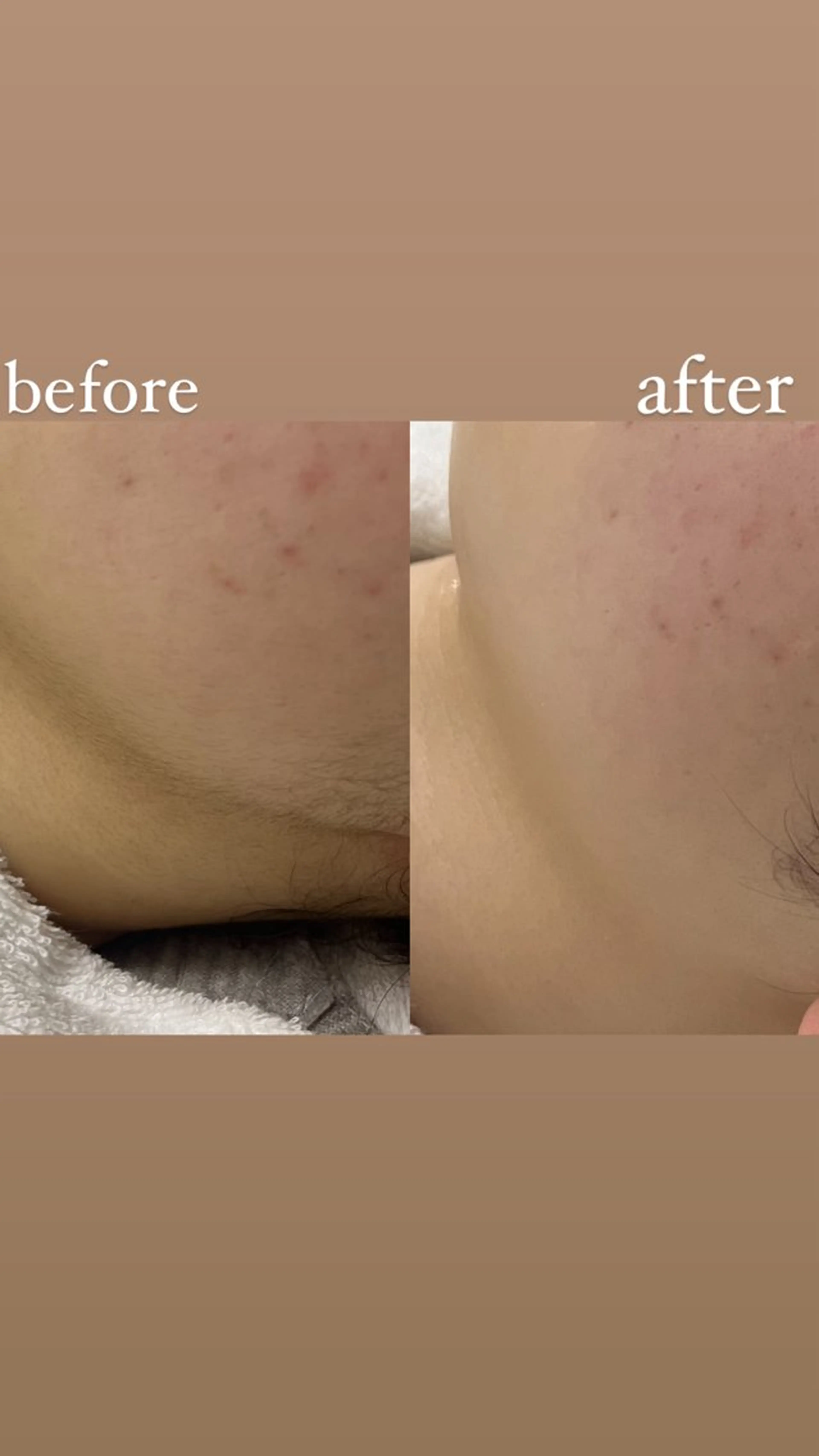 女性専門お顔剃り sunraineのエステ・リラクイメージ