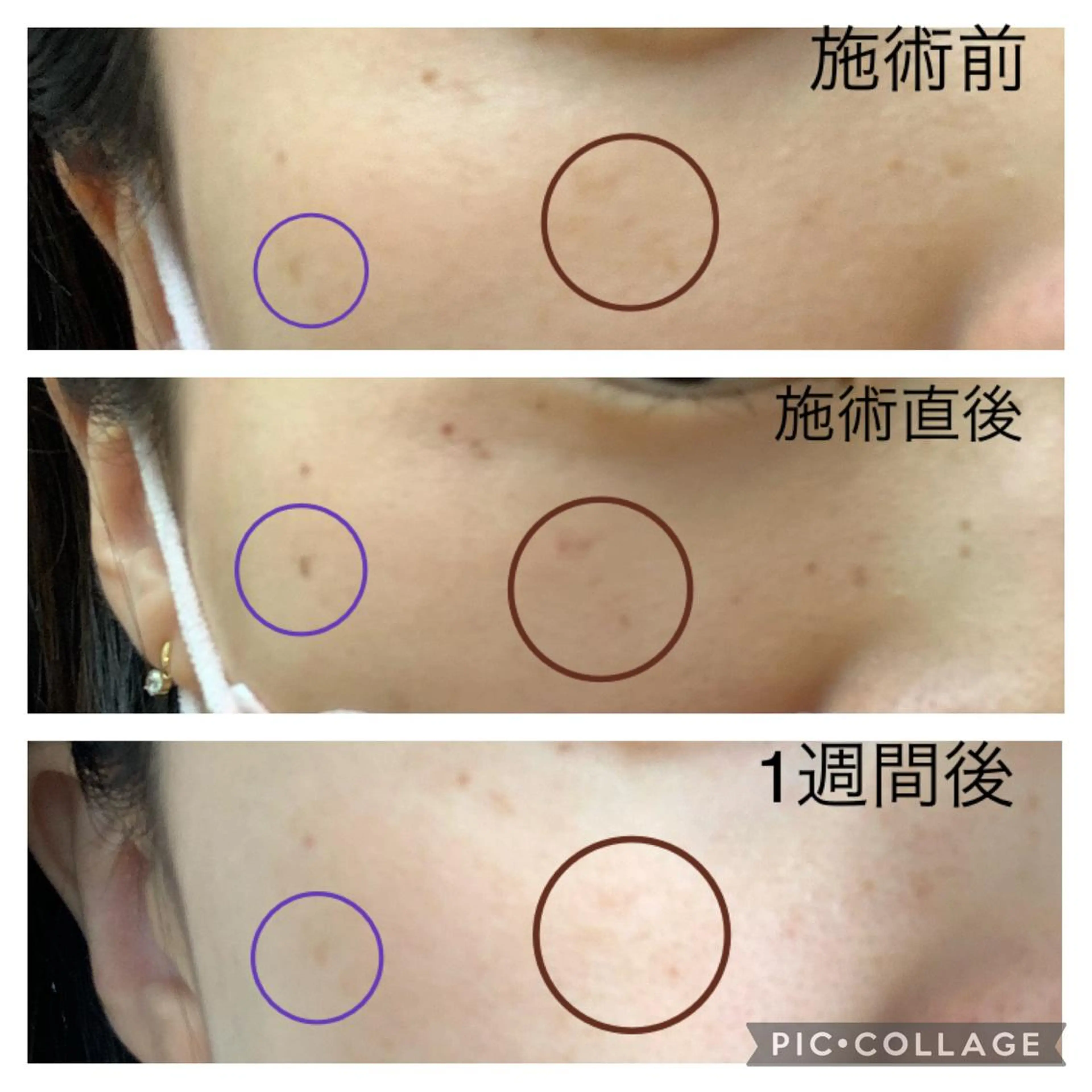 エステ シミケア E Lashのエステ・リラクイメージ