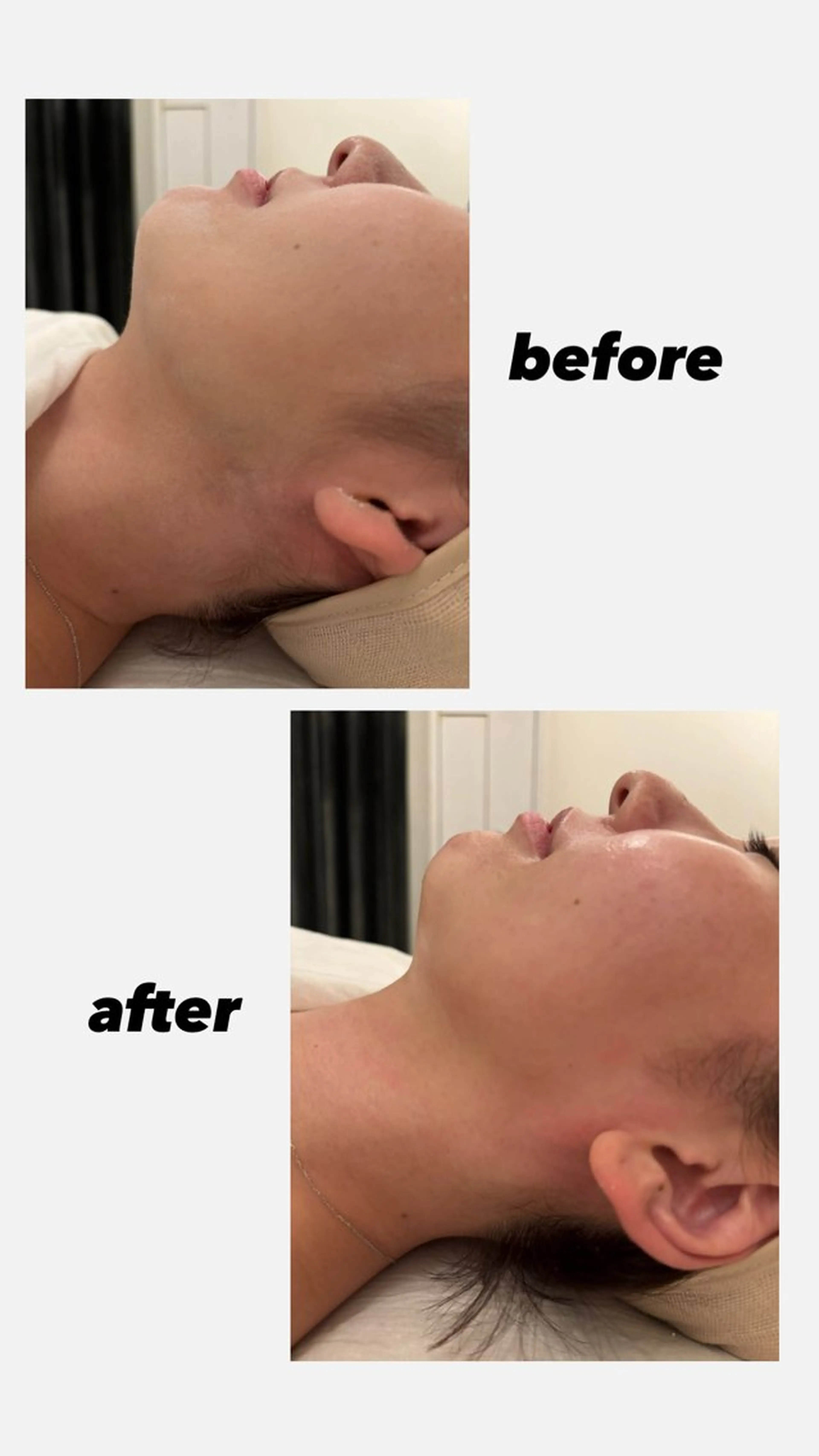 une所属・une シュガーリング脱毛のエステ・リラクイメージ