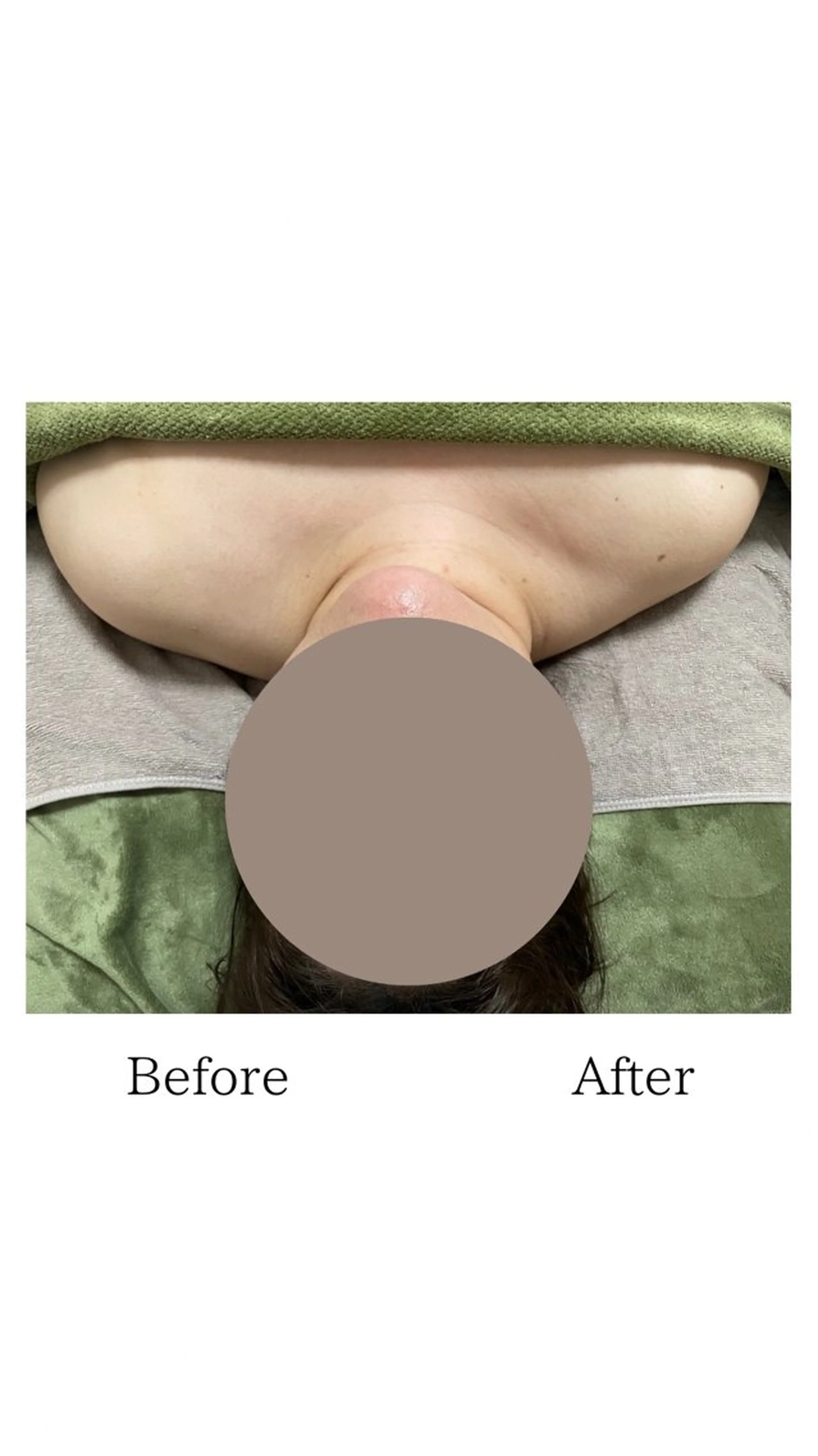 美容鍼灸サロン   colorier所属・美容鍼灸サロン colorierのエステ・リラクイメージ