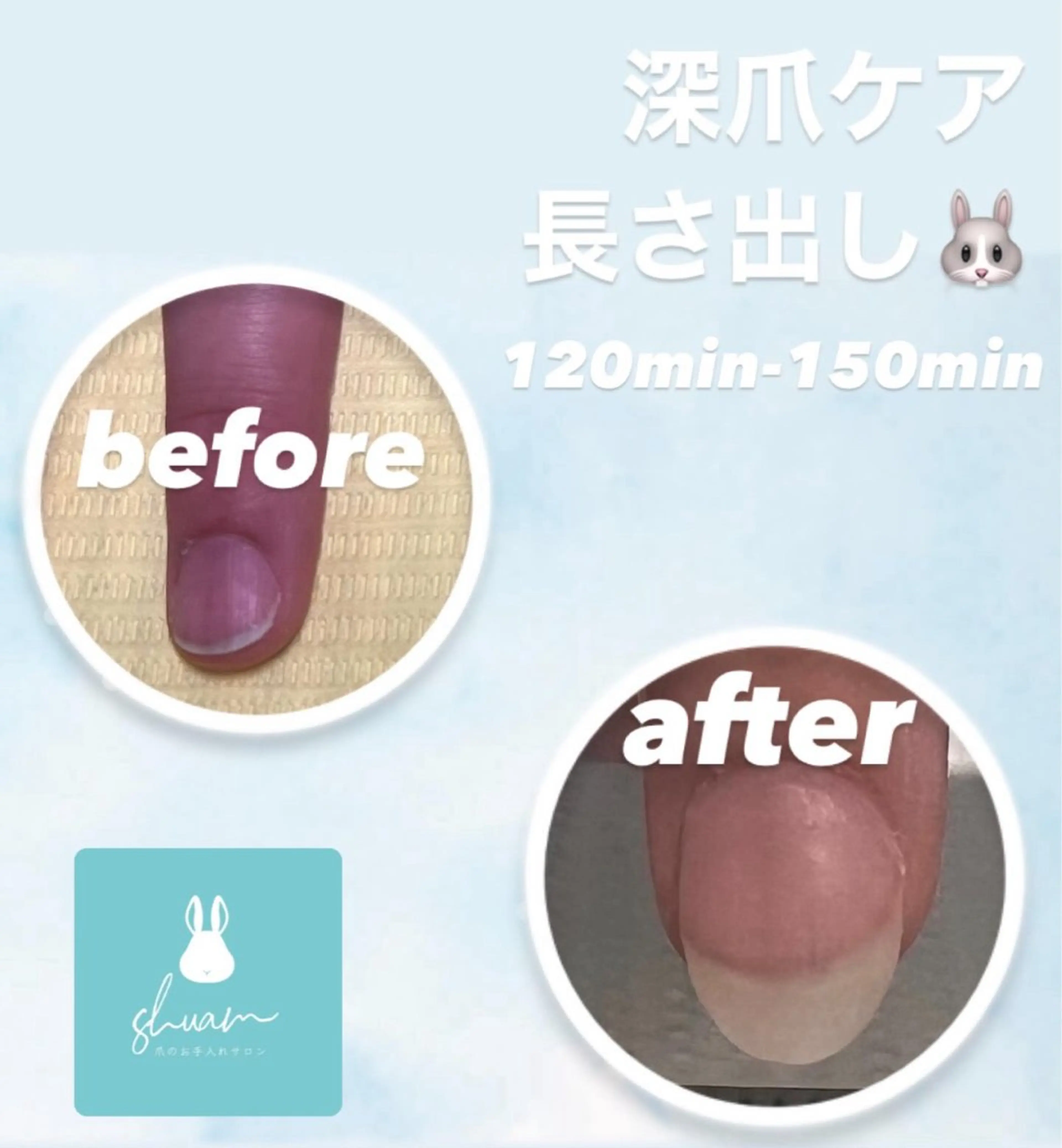 メンズ ネイル ハンドネイル 爪ケア/深爪 自爪育成 🐰えむのネイルデザイン