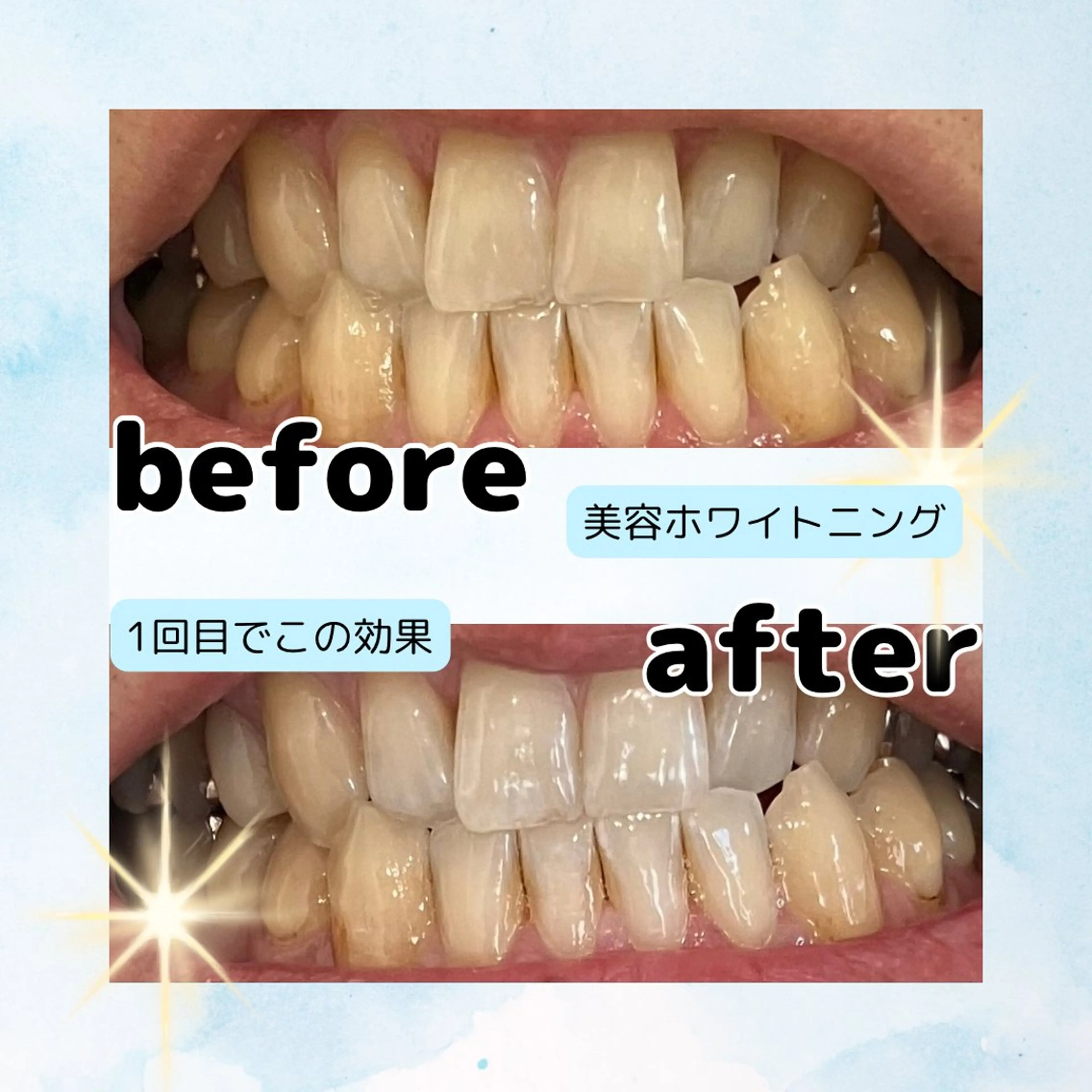 ホワイトニングサロン Soleilのその他イメージ