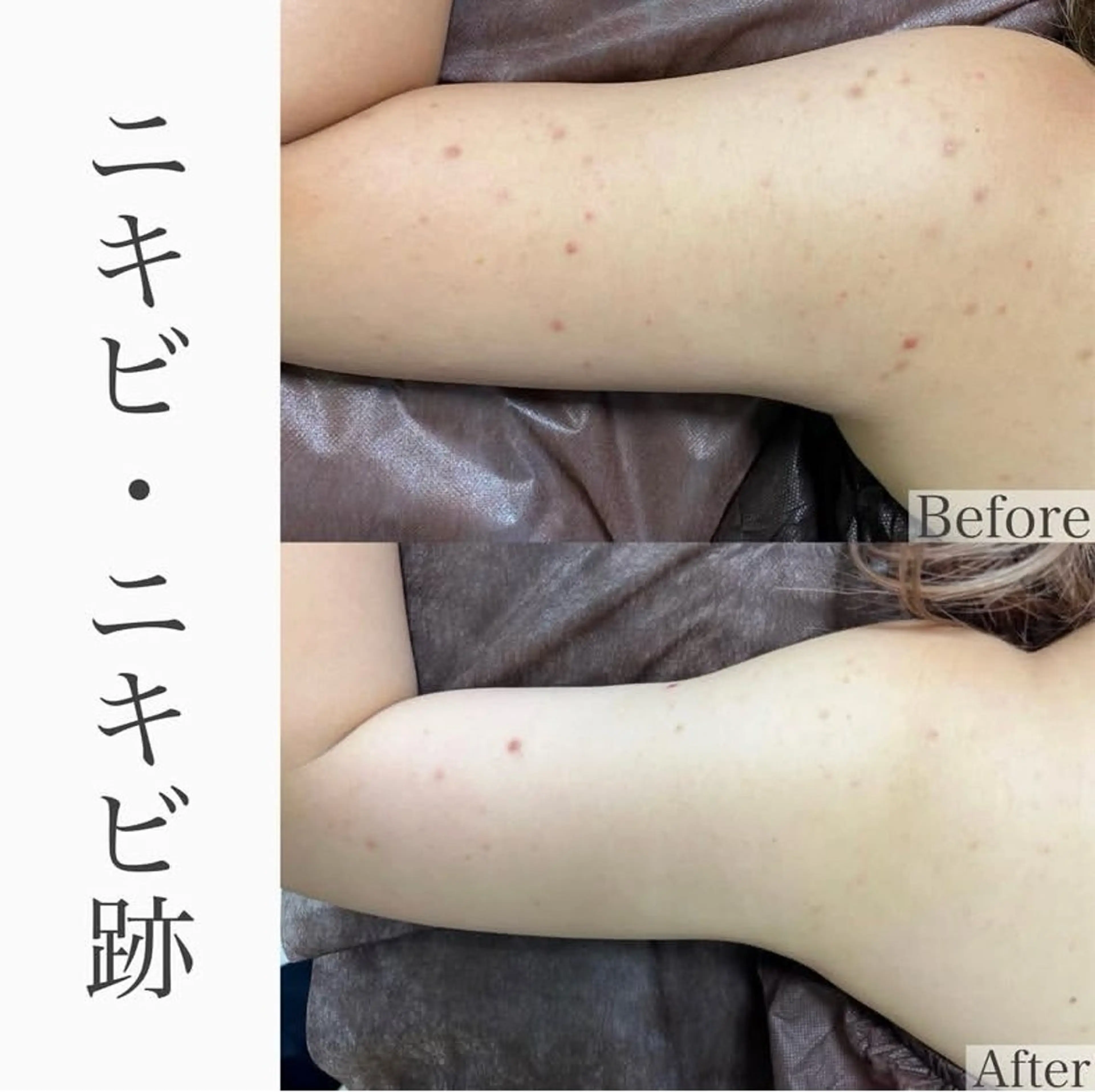 その他 ハーブピーリング専門 BIOPLUS＋川崎のエステ・リラクイメージ