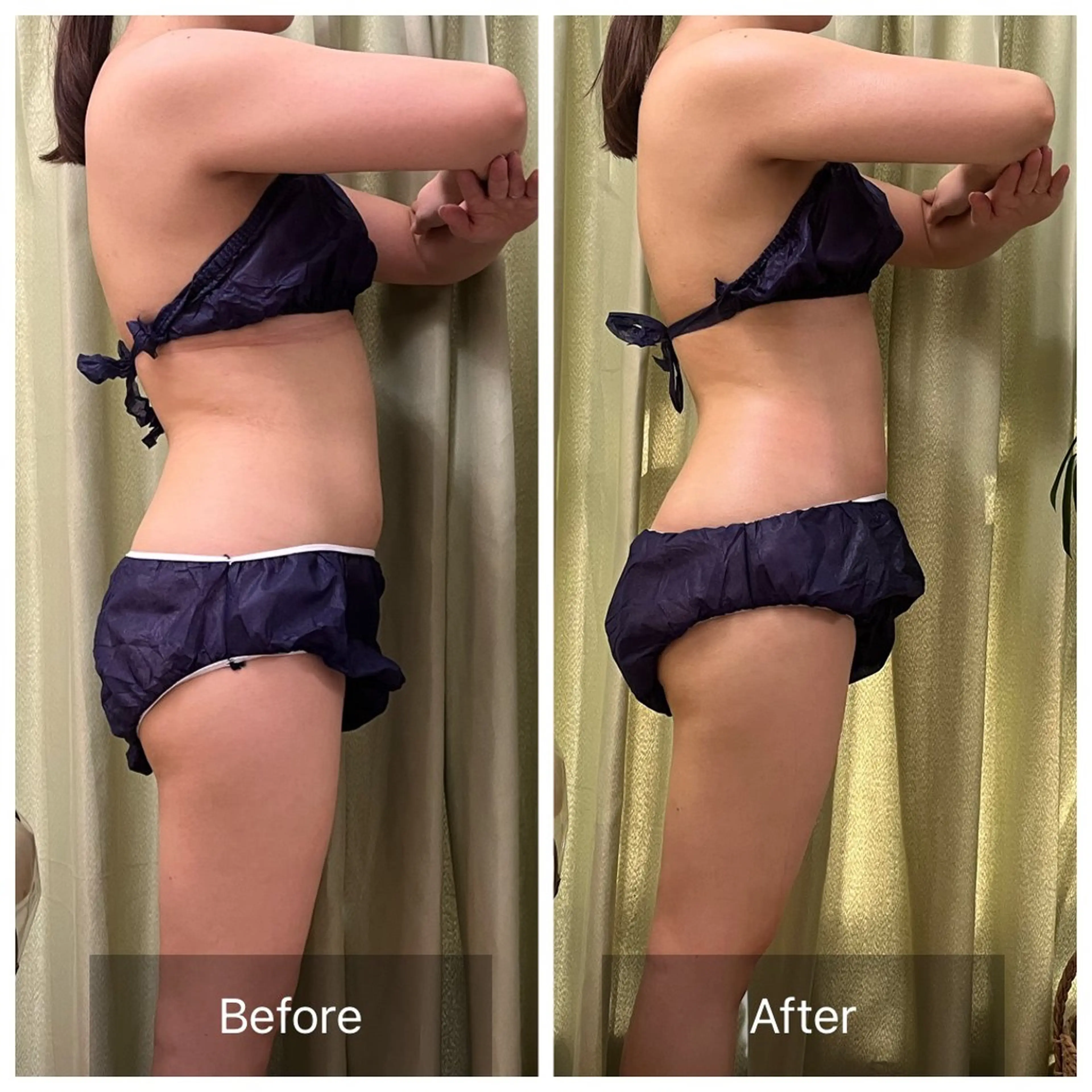 エステ リラク 【元に戻らない】 小顔&部分痩せのその他イメージ