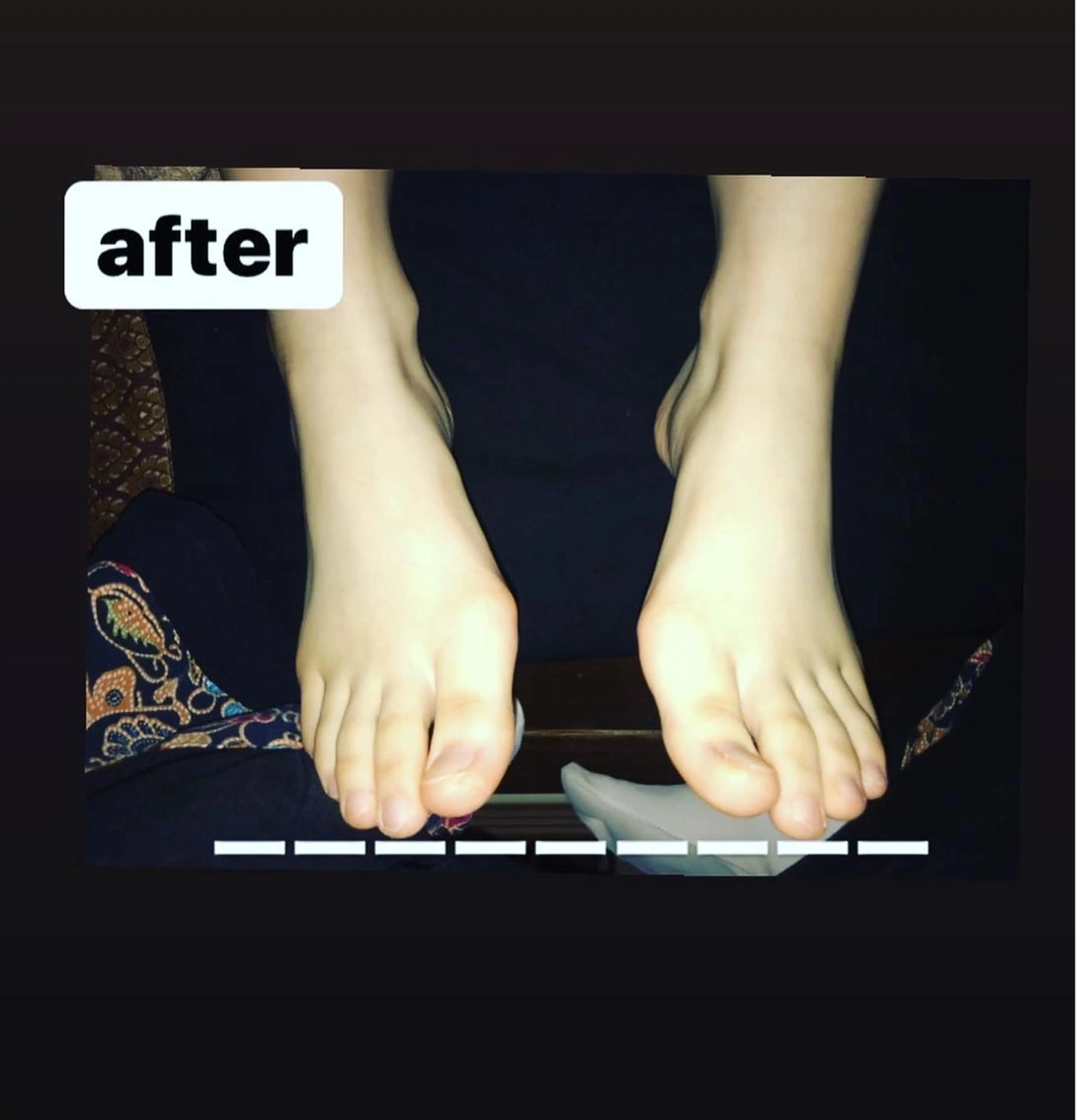 リラク 【足圧】鬼👹リンパ 身体整うサロンのエステ・リラクイメージ