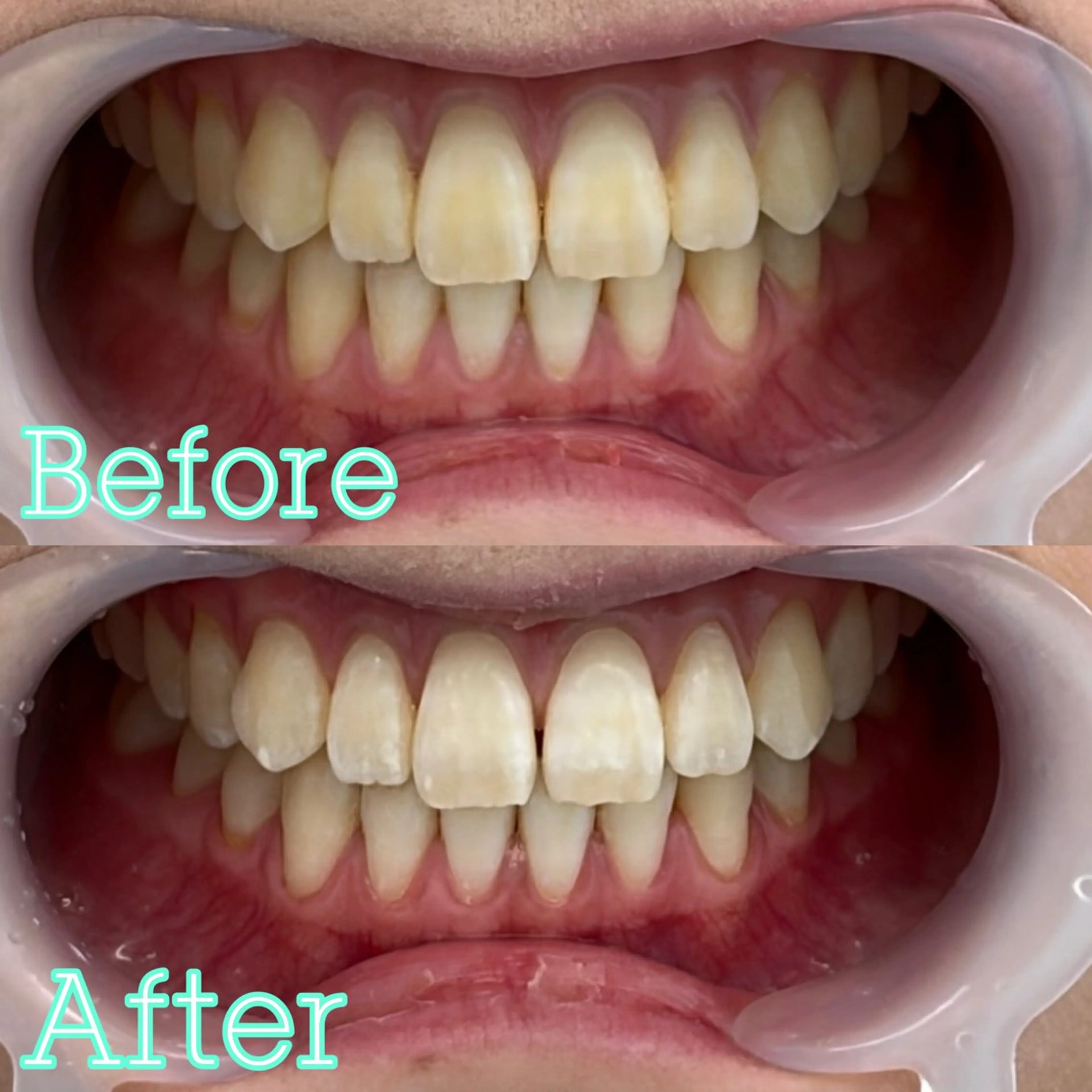 歯のホワイトニング専門店 MIGAQ 京都四条大宮店所属・佐藤 未来の眉毛・アイブロウイメージ