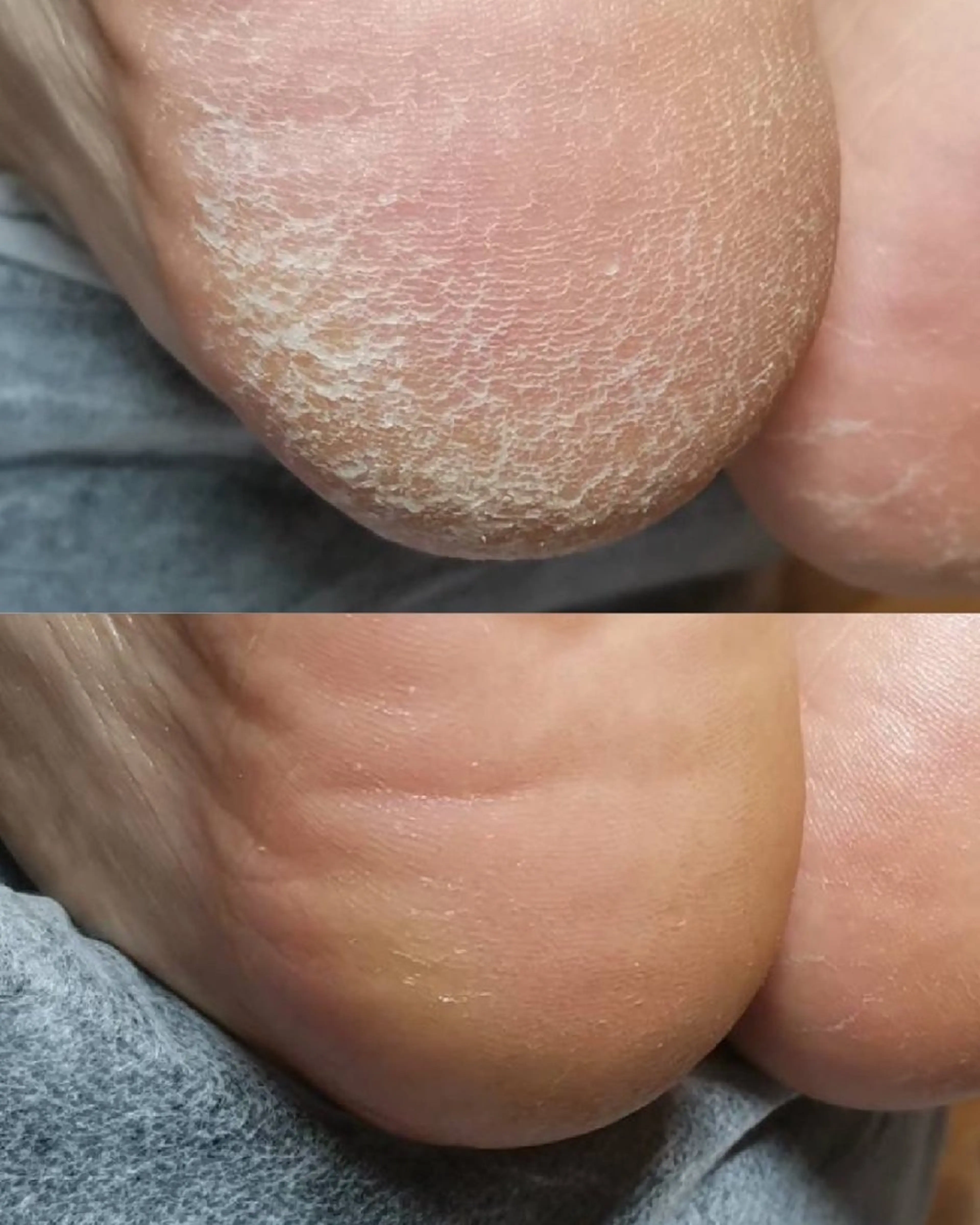 ネイル ROUN' 齋藤のエステ・リラクイメージ