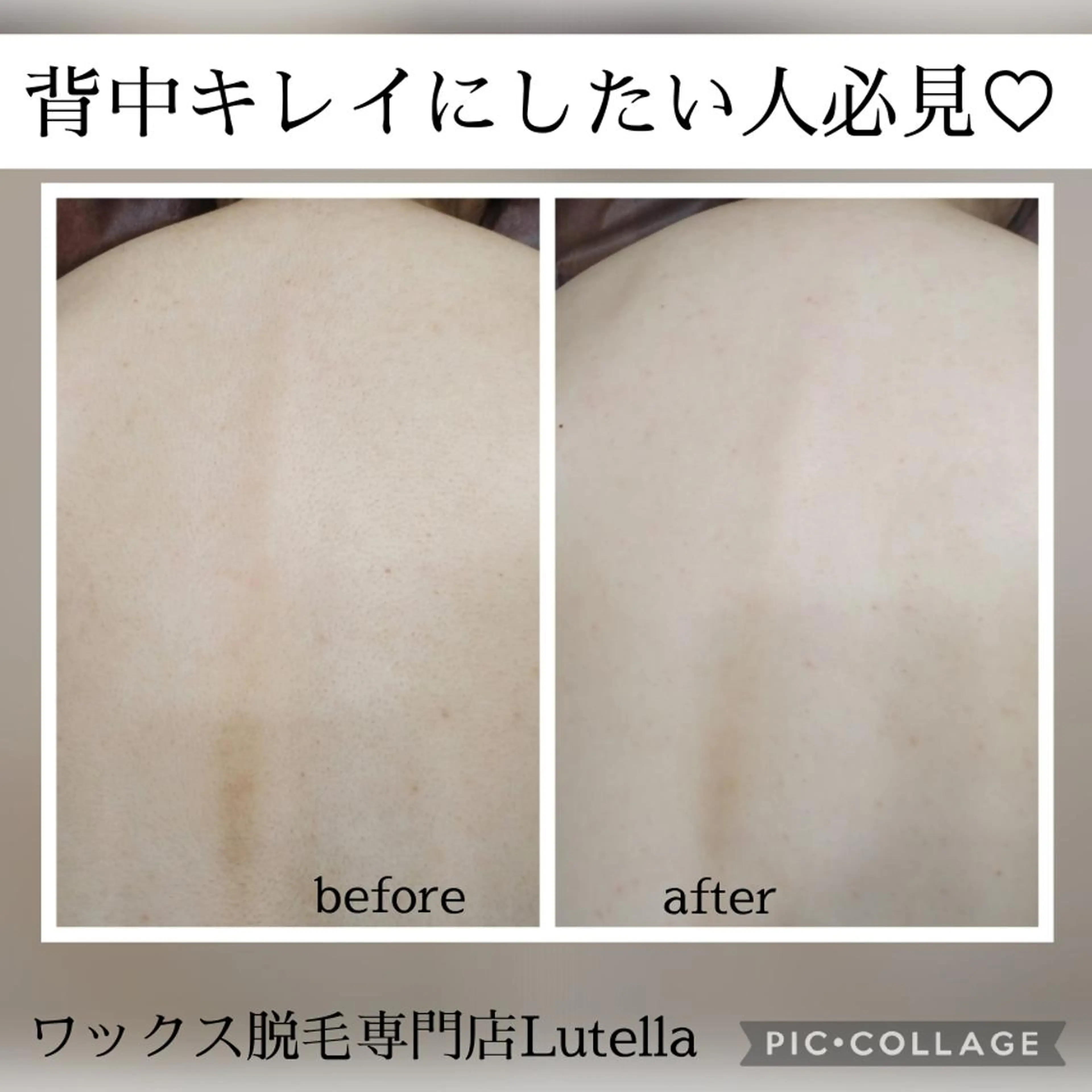 Lutella所属・ワックス脱毛専門店 Lutellaのエステ・リラクイメージ