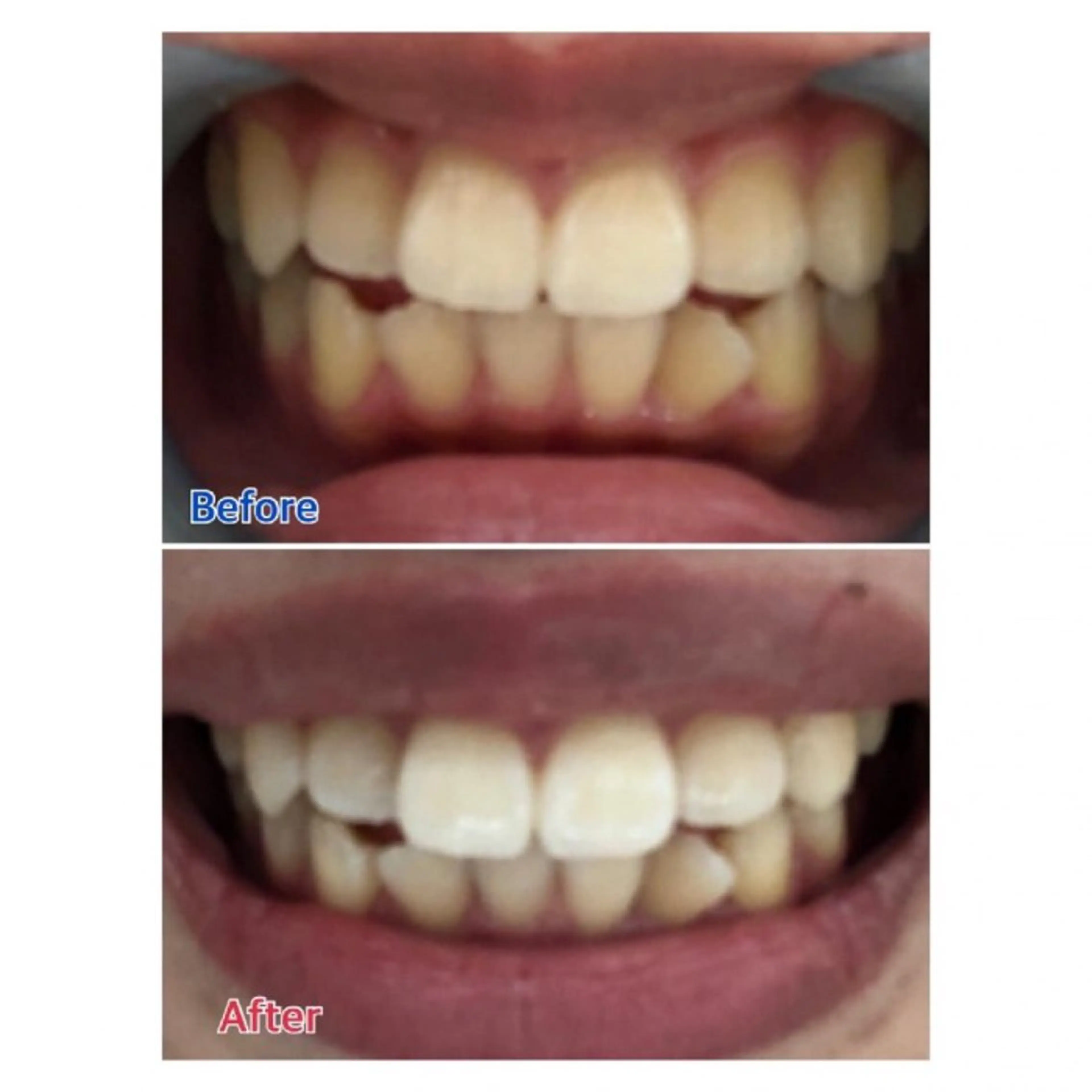 M渋谷店所属・Ｍ渋谷 ホワイトニングのその他イメージ