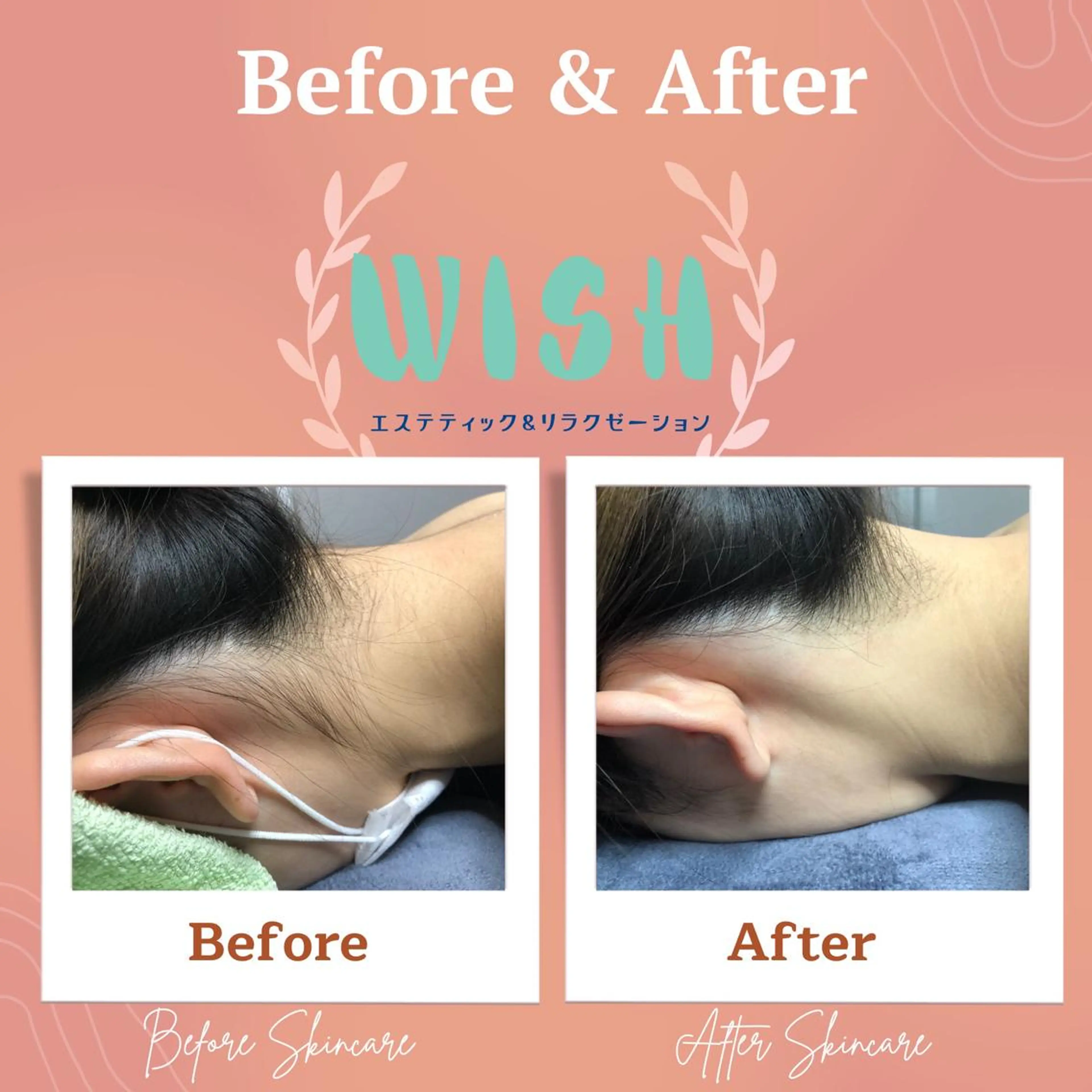 WISH 美肌脱毛のプロ！須藤のエステ・リラクイメージ