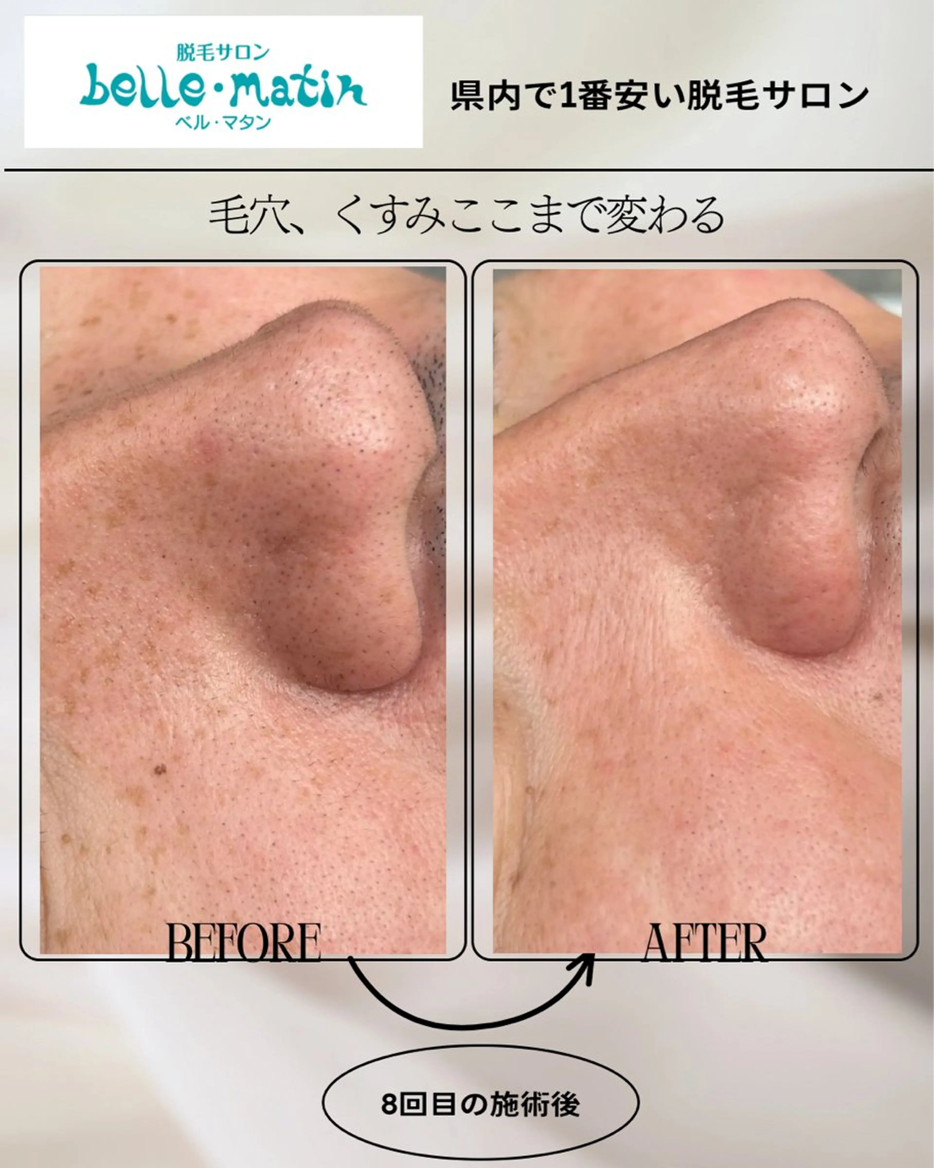 エステ 脱毛サロン　　　ベル・マタン所属・脱毛サロン ベル・マタンのエステ・リラクイメージ