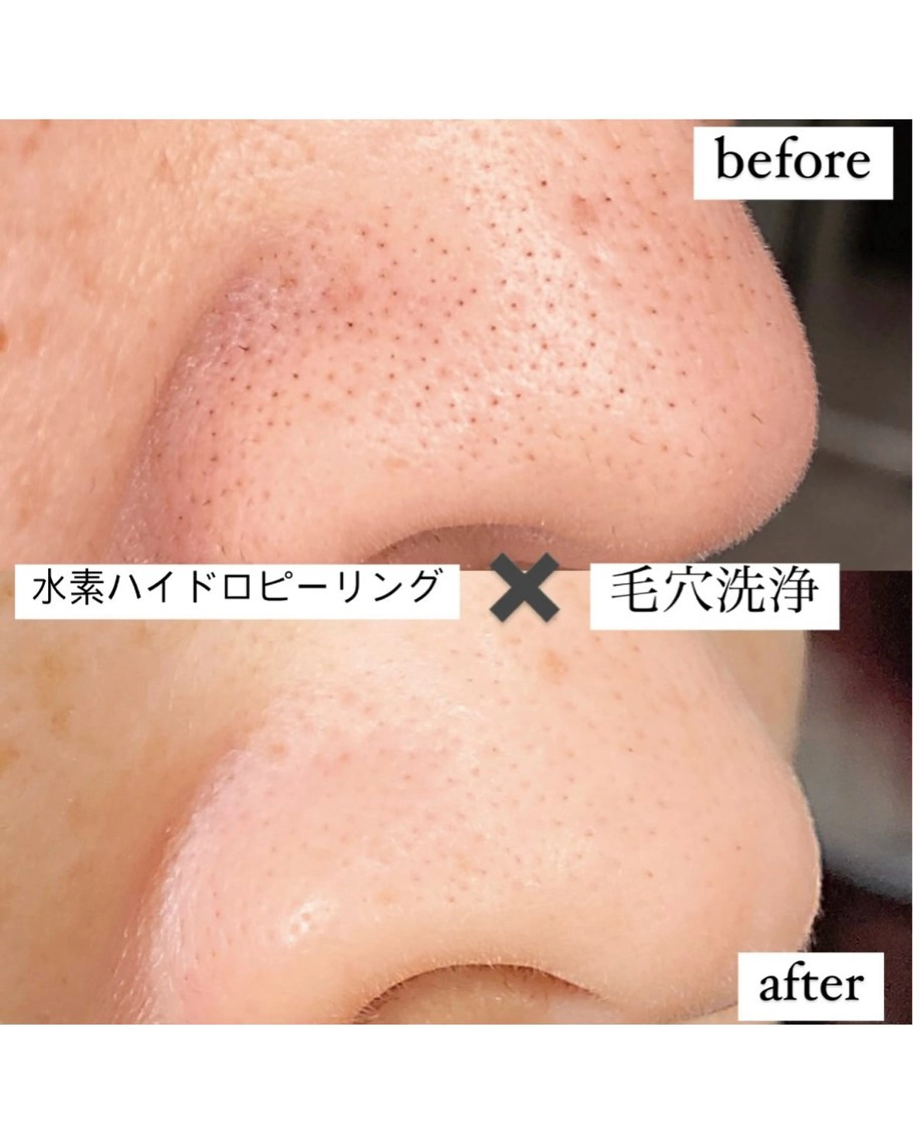 Moana モアナのエステ・リラクイメージ