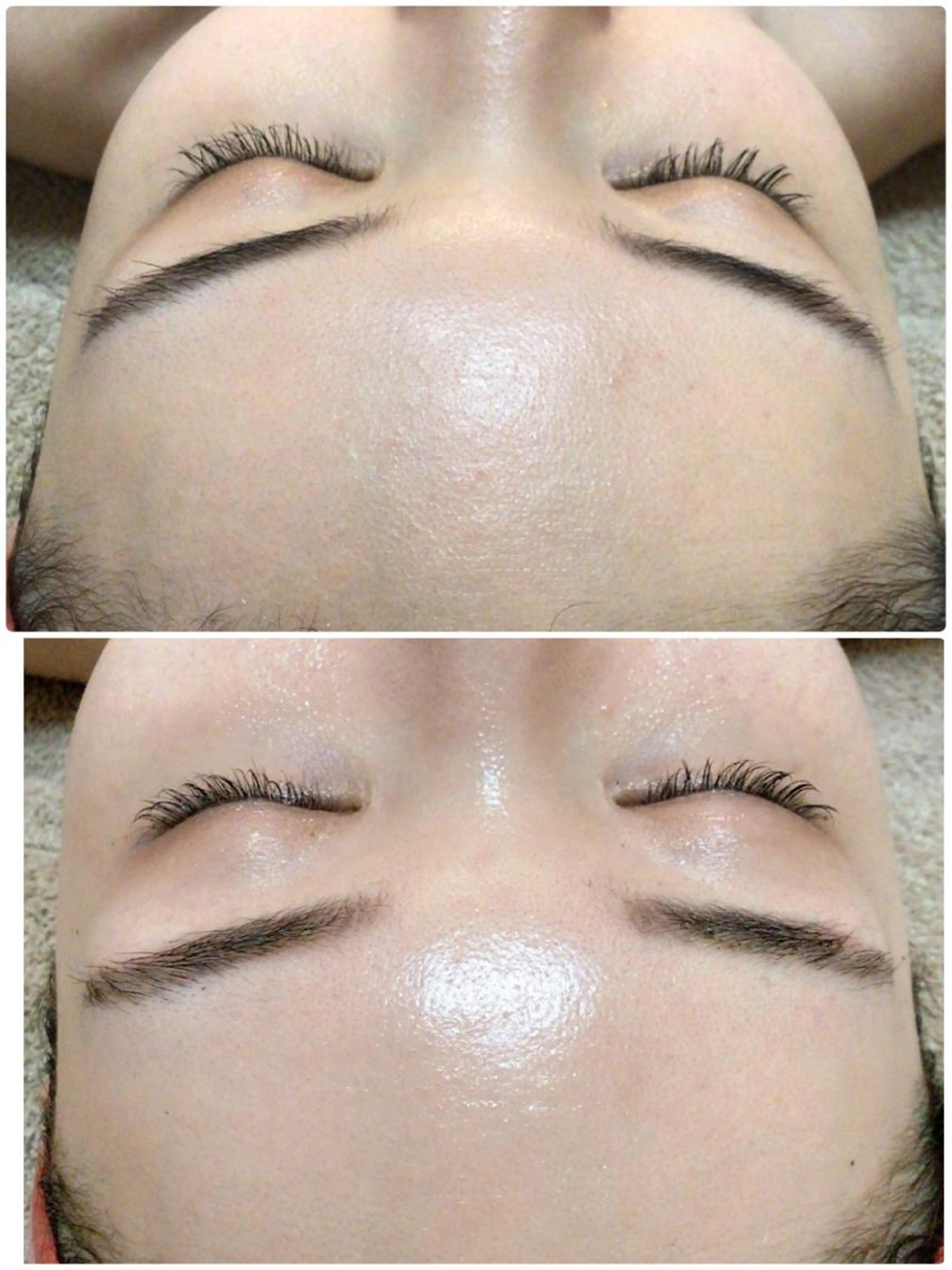 【ハーブピーリング】たっぷり2g《 REVI  陶肌トリートメント》剥離なし！次世代ハーブピーリングの写真