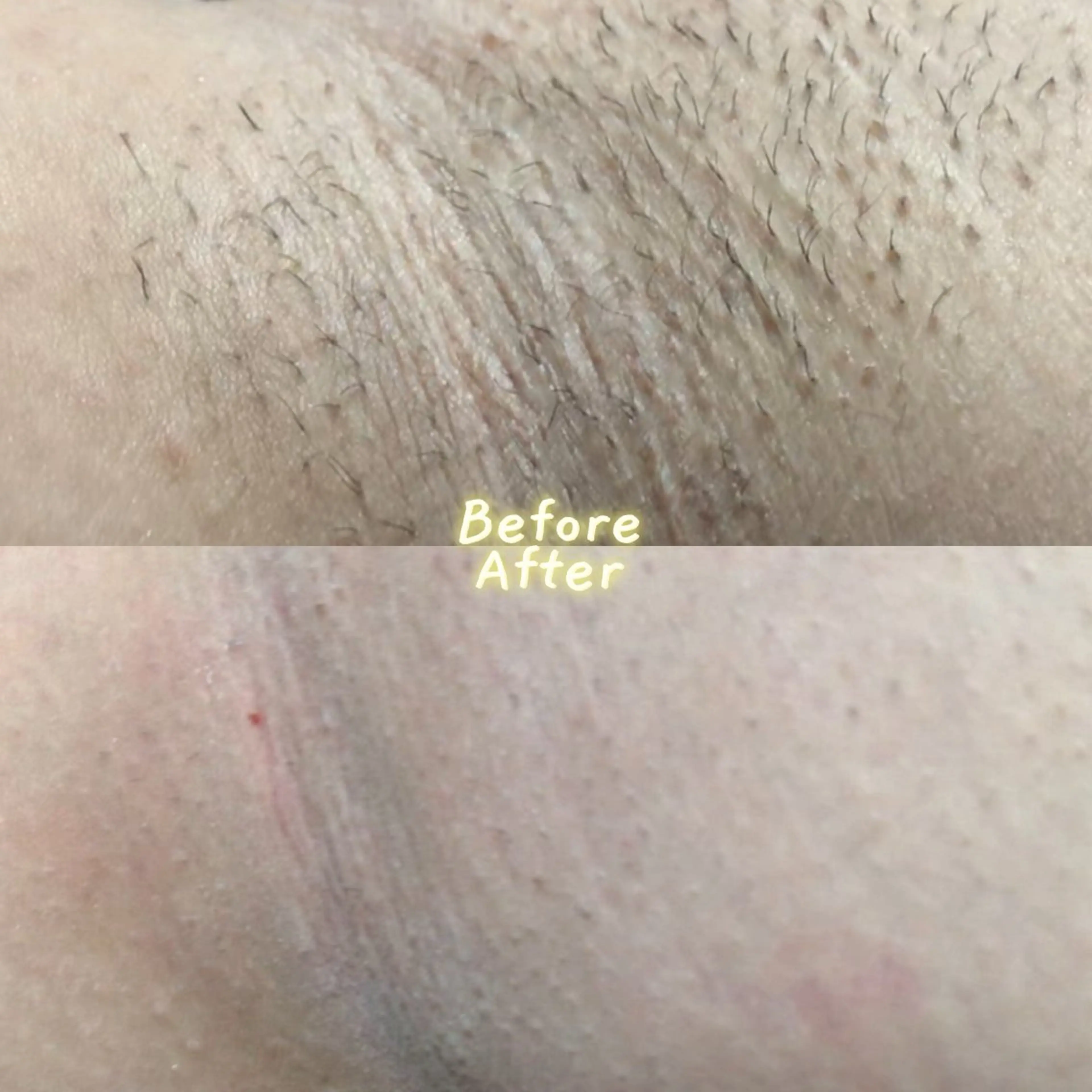 Hit. シュガーリング豊橋のエステ・リラクイメージ