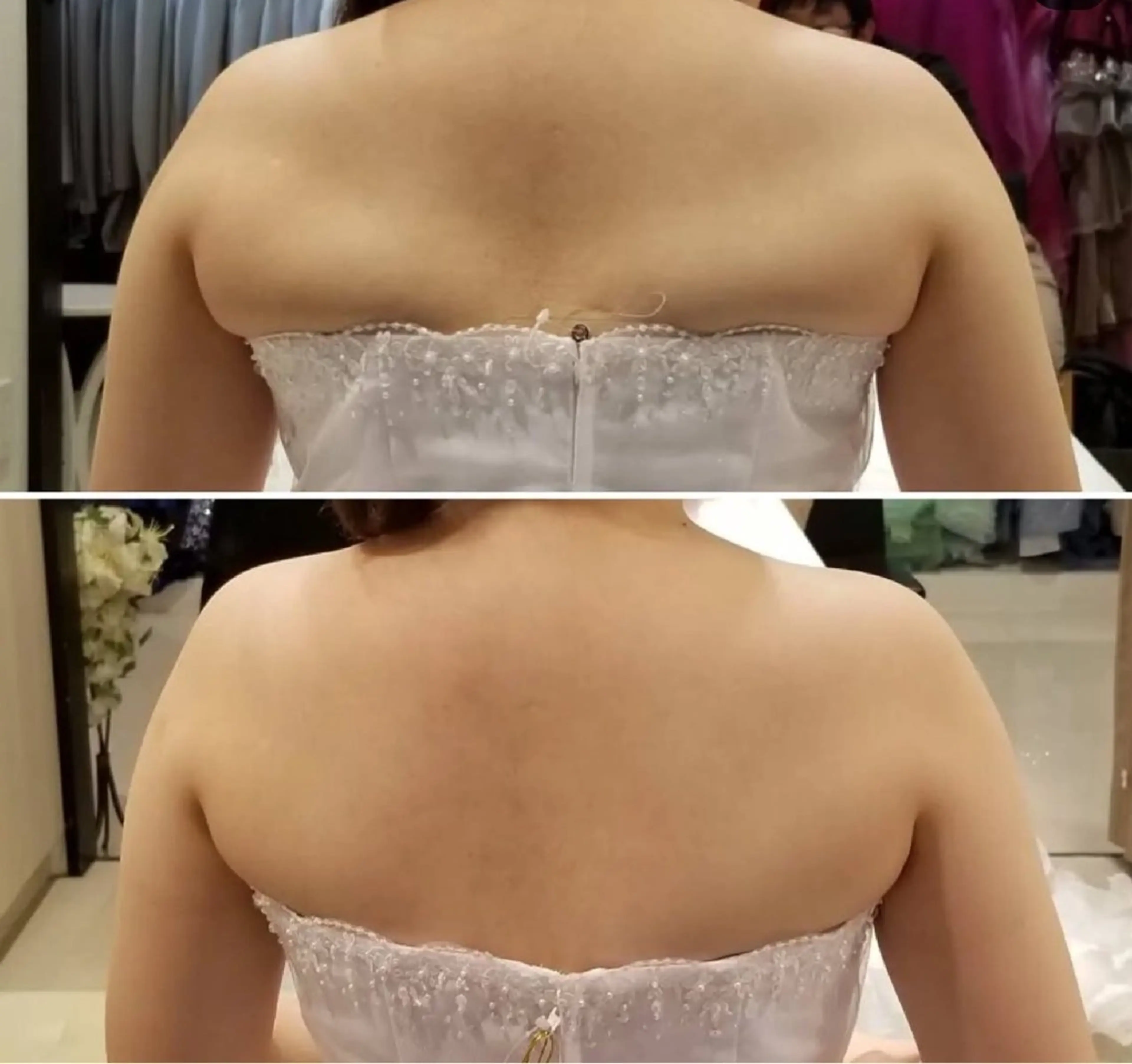 ニキビケア&ニキビ跡 レゾン京橋店 のエステ・リラクイメージ