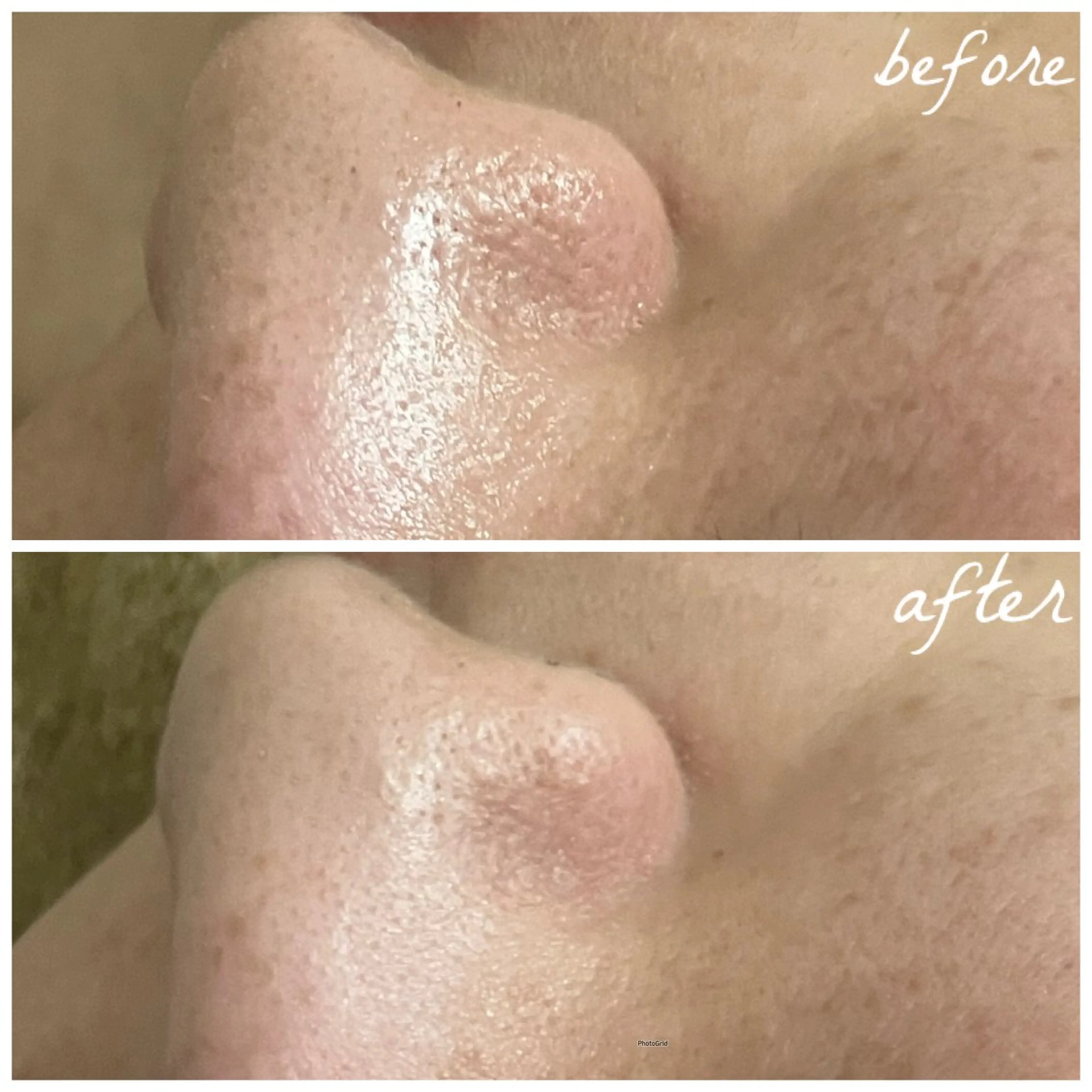 メンズ エステ メナード岐阜茜部 杉浦のエステ・リラクイメージ