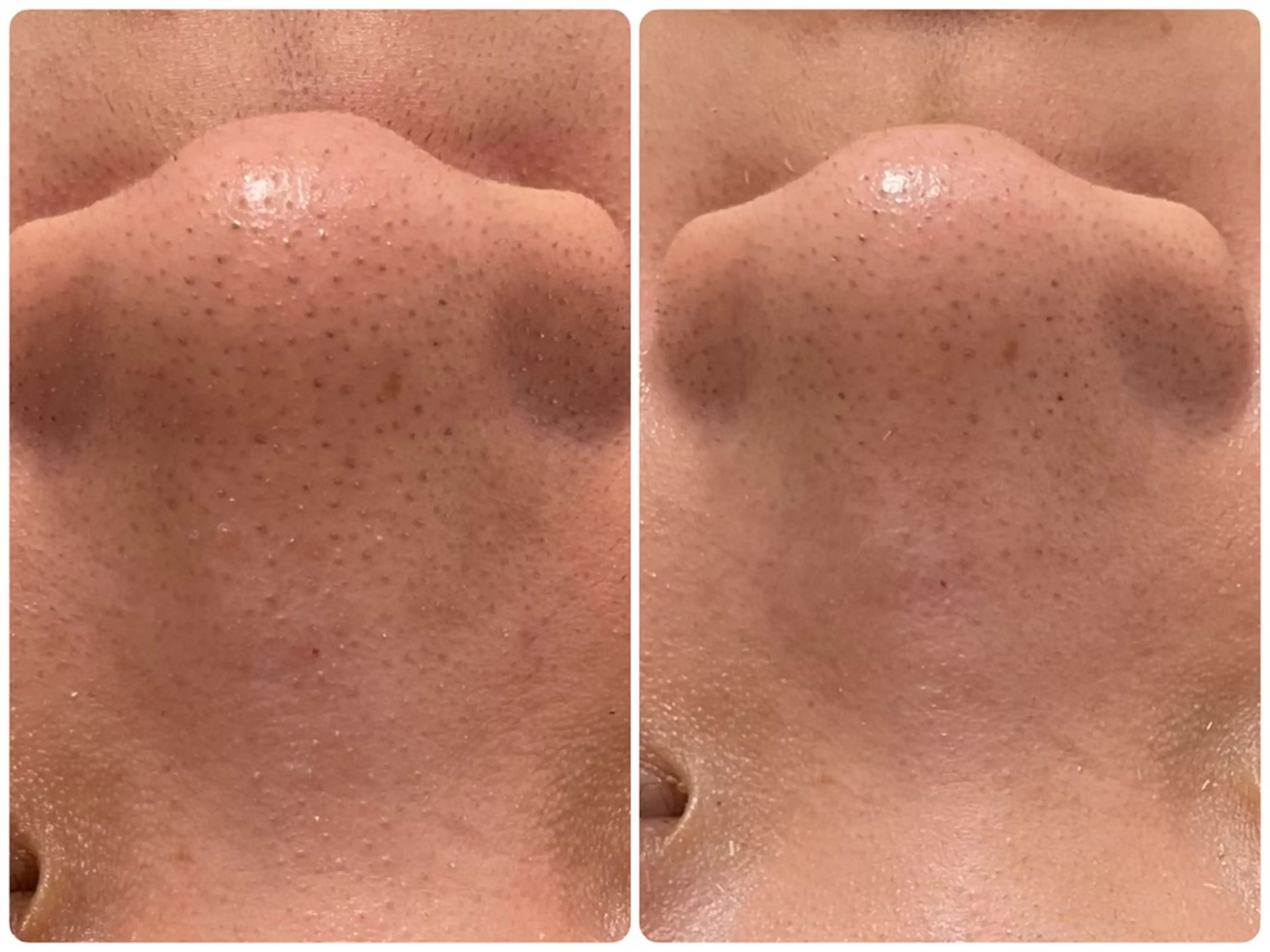 イデアルMe♡ NAKAMURAのその他イメージ