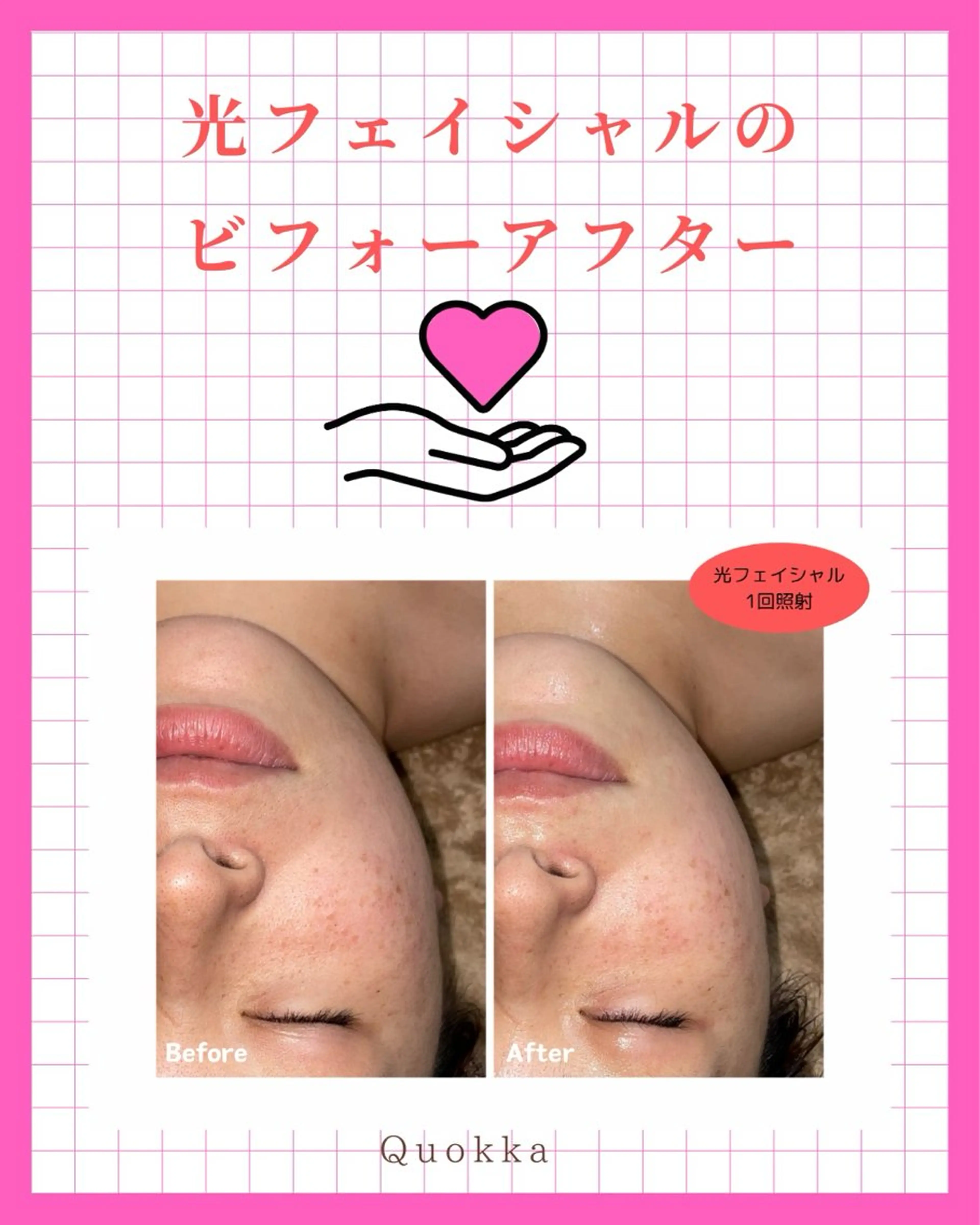 エステ Quokka ✴︎ あま市甚目寺のエステ・リラクイメージ