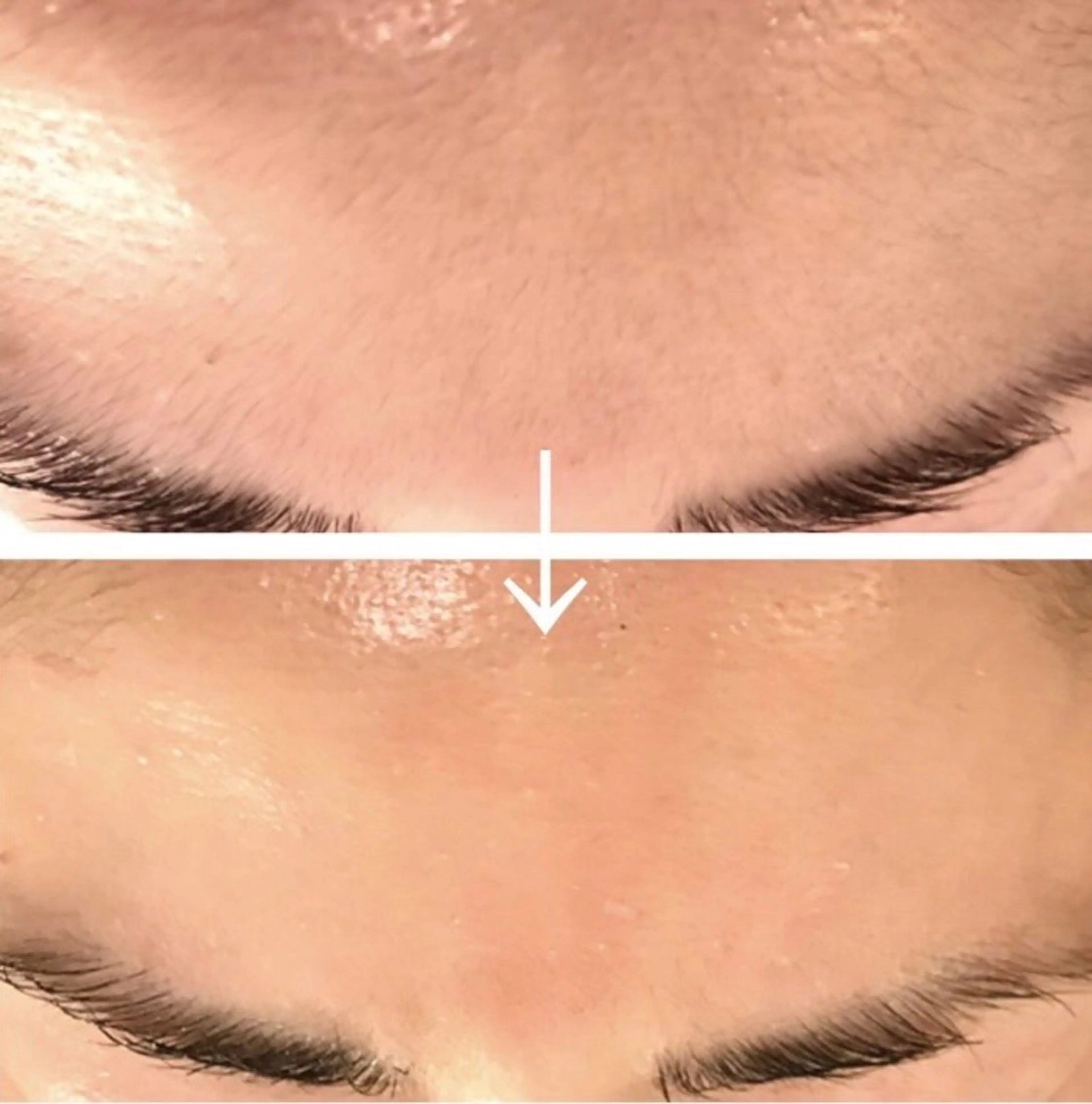 脱毛 中村 えり子のエステ・リラクイメージ