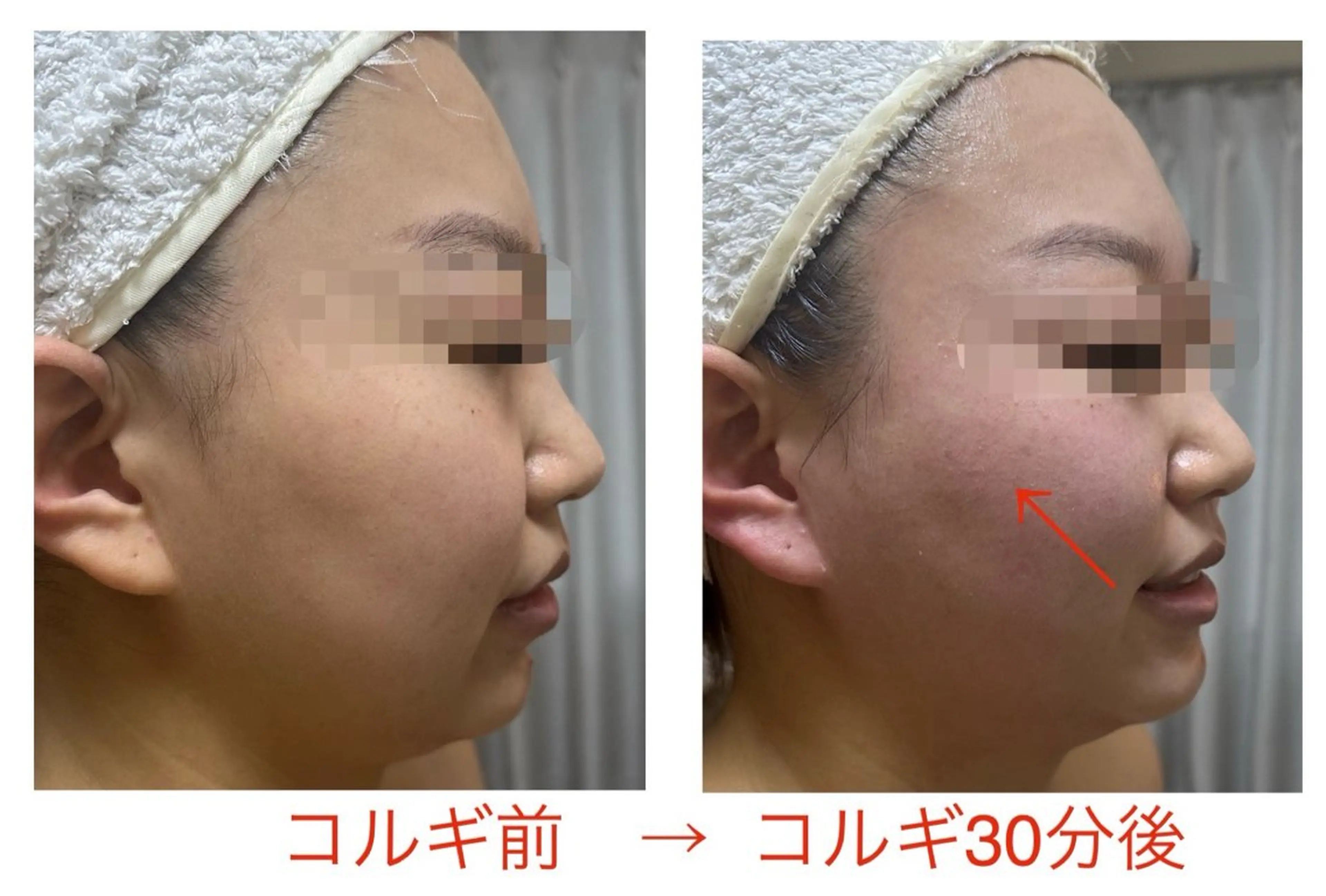 小顔コルギ10年 みなみ・池袋のエステ・リラクイメージ