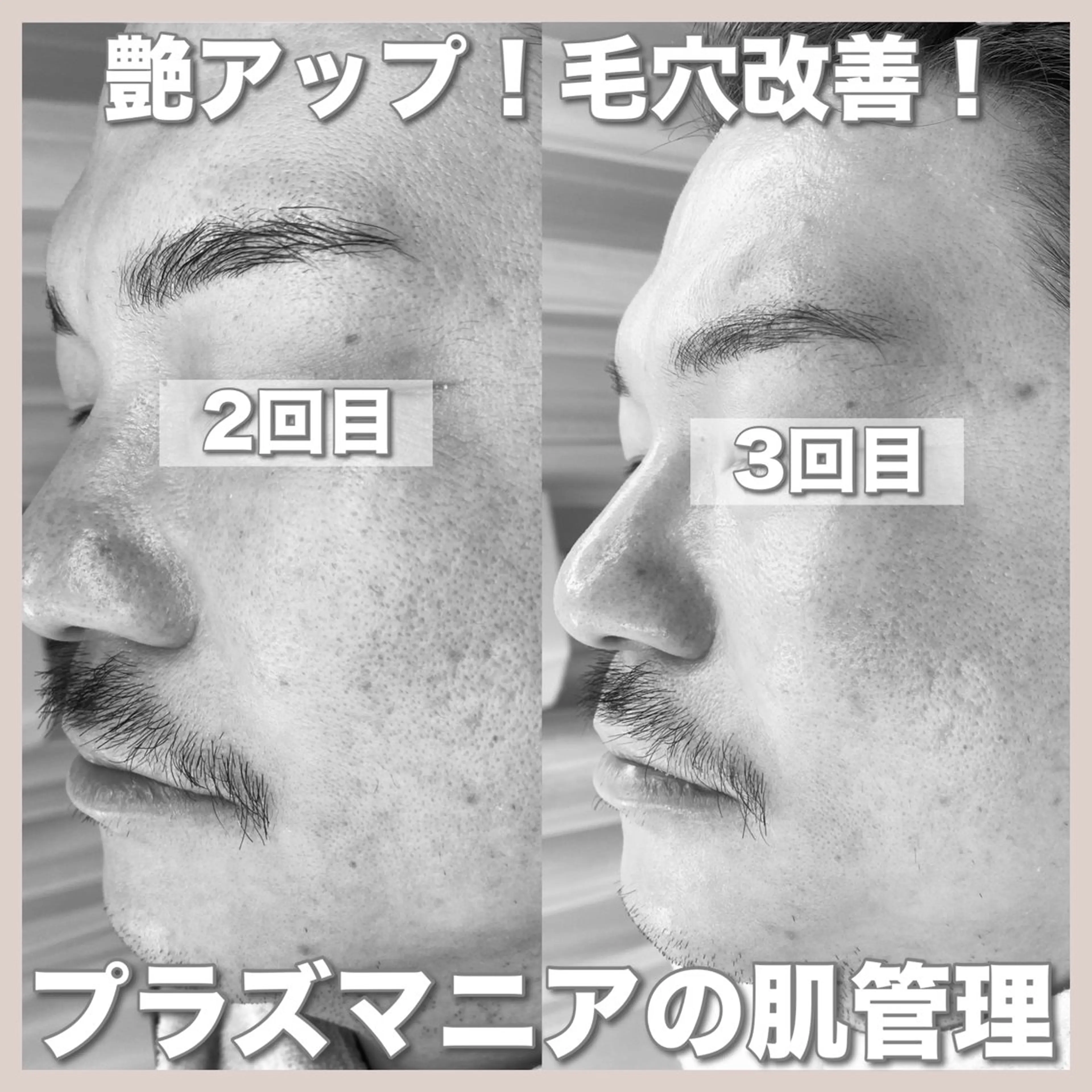 エステ mone~total care salon~所属・mone (モーネ)のマツエク・マツパデザイン