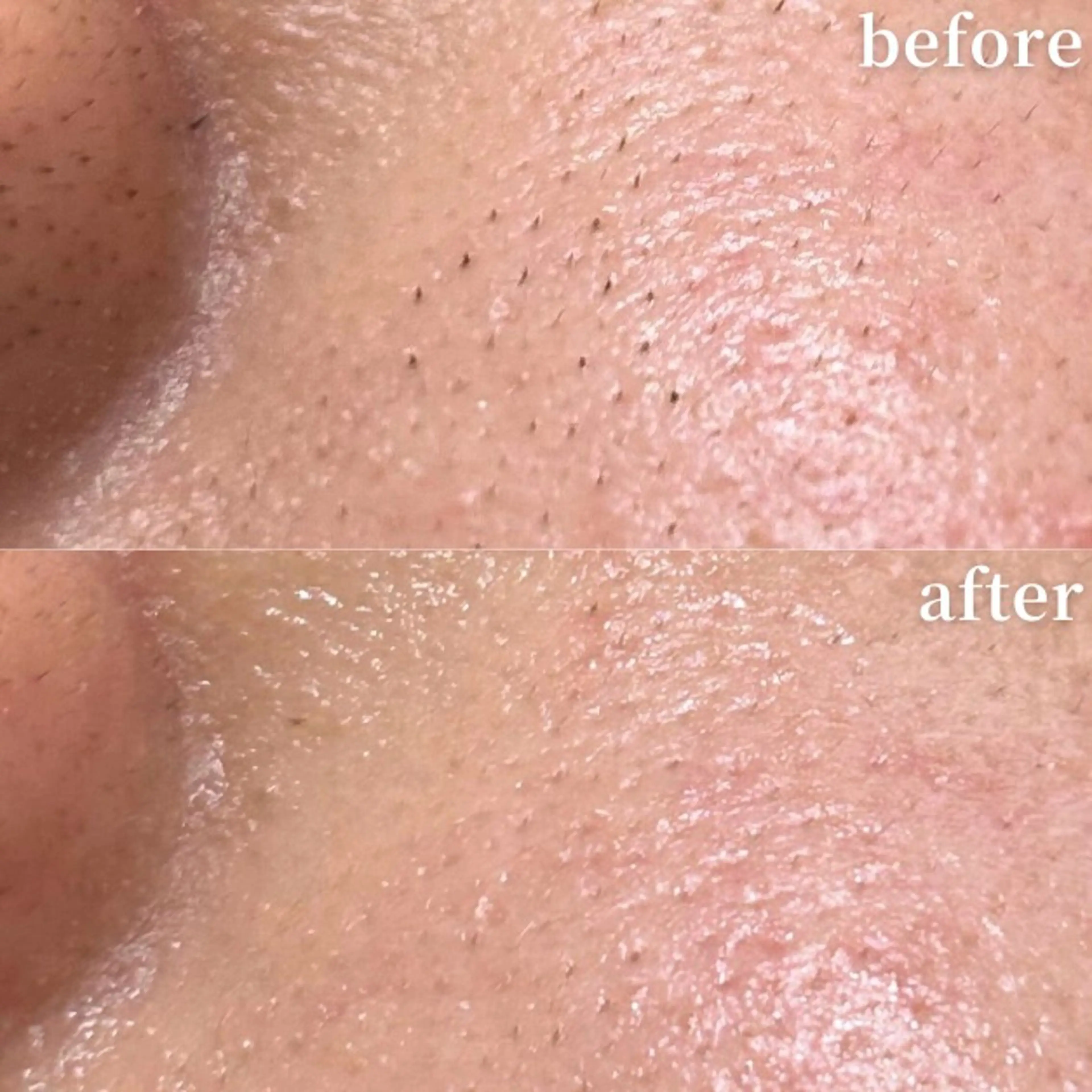 毛穴専門サロンLatiele所属・毛穴専門サロン Latieleのエステ・リラクイメージ