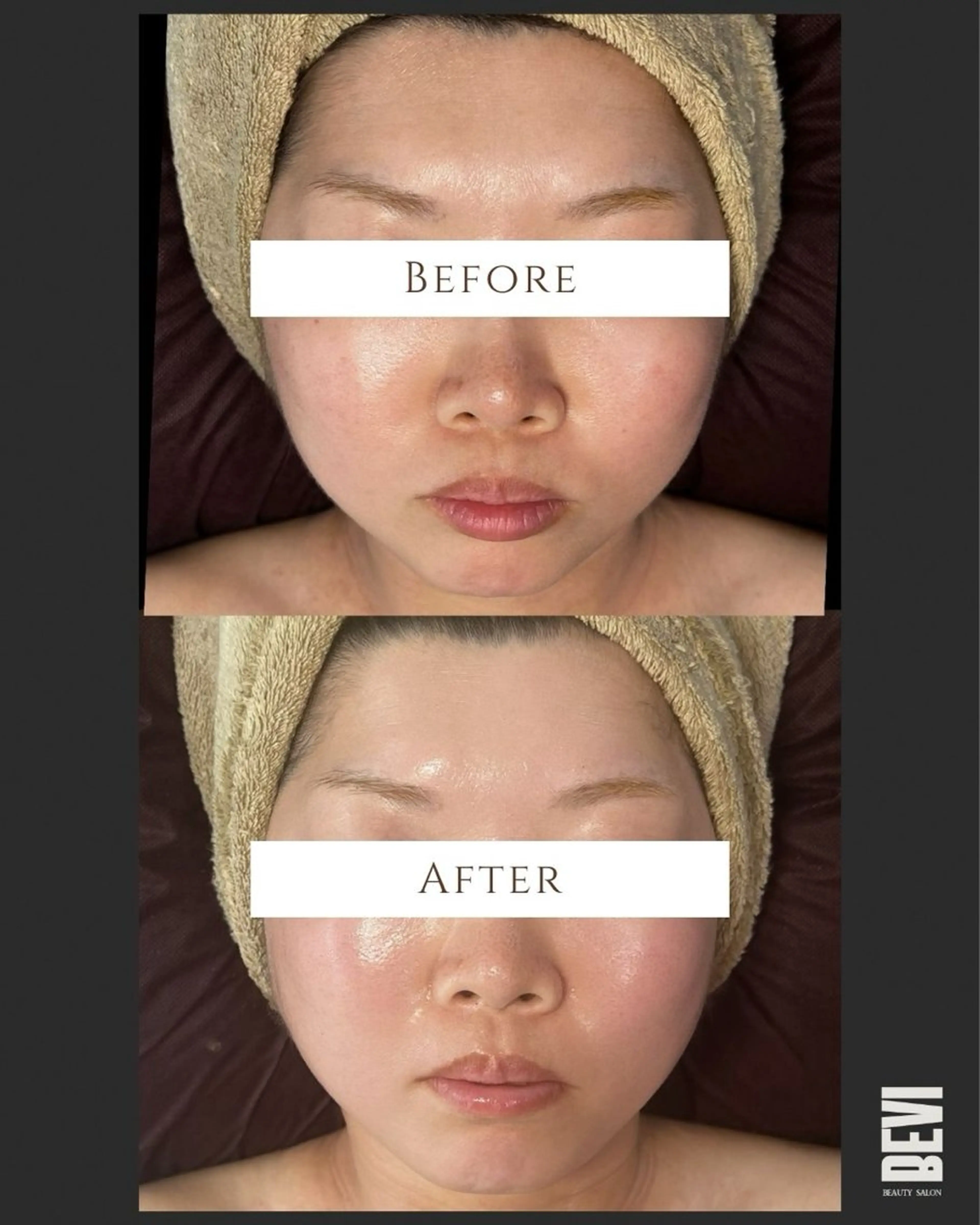 Bevi salonのその他イメージ