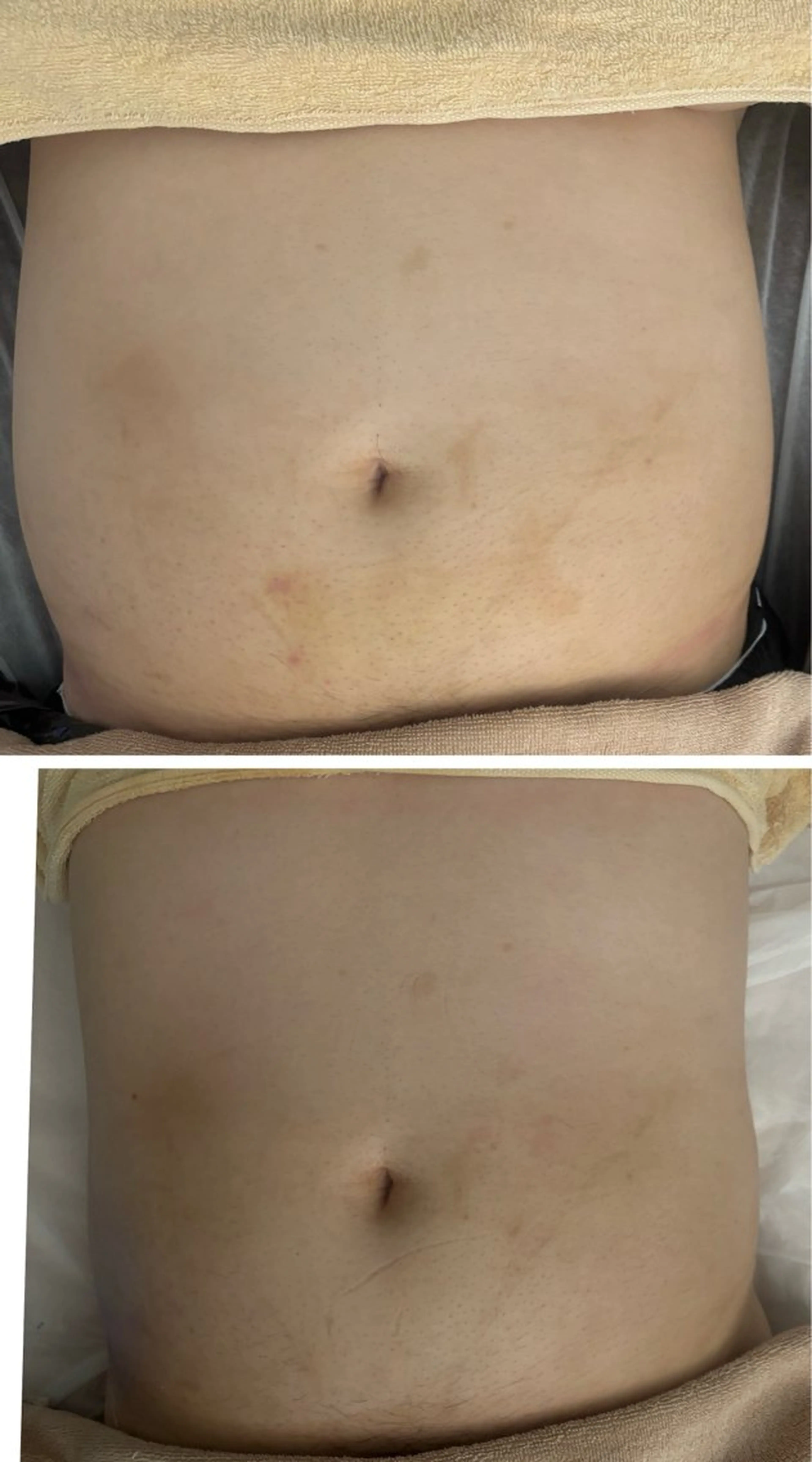 solo tu  salon MANA所属・美肌＆痩身＆脱毛 MANAのエステ・リラクイメージ