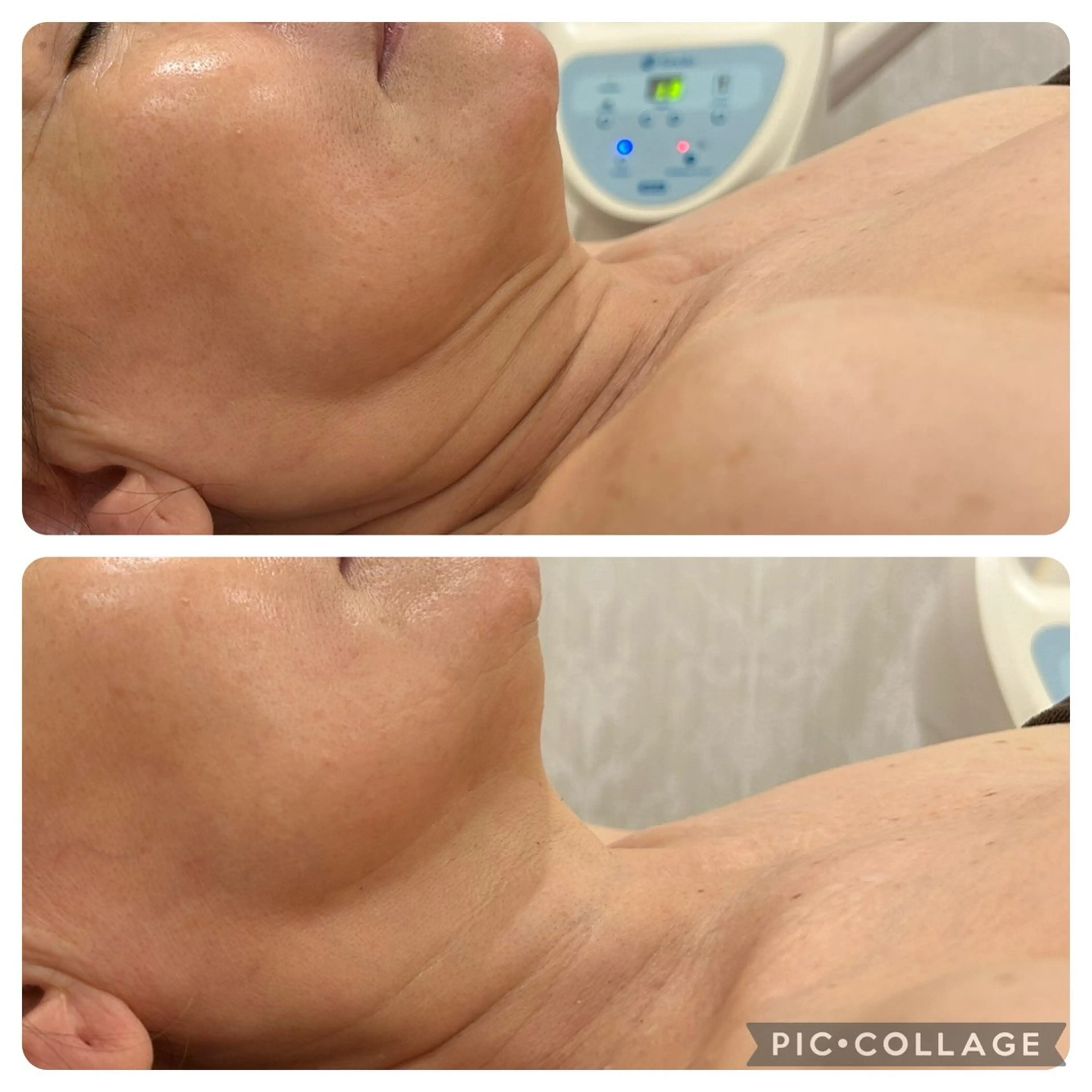 Silky ✖︎ Snow White｜エイジングケア＆美肌脱毛専門サロン所属・O 朋美のエステ・リラクイメージ