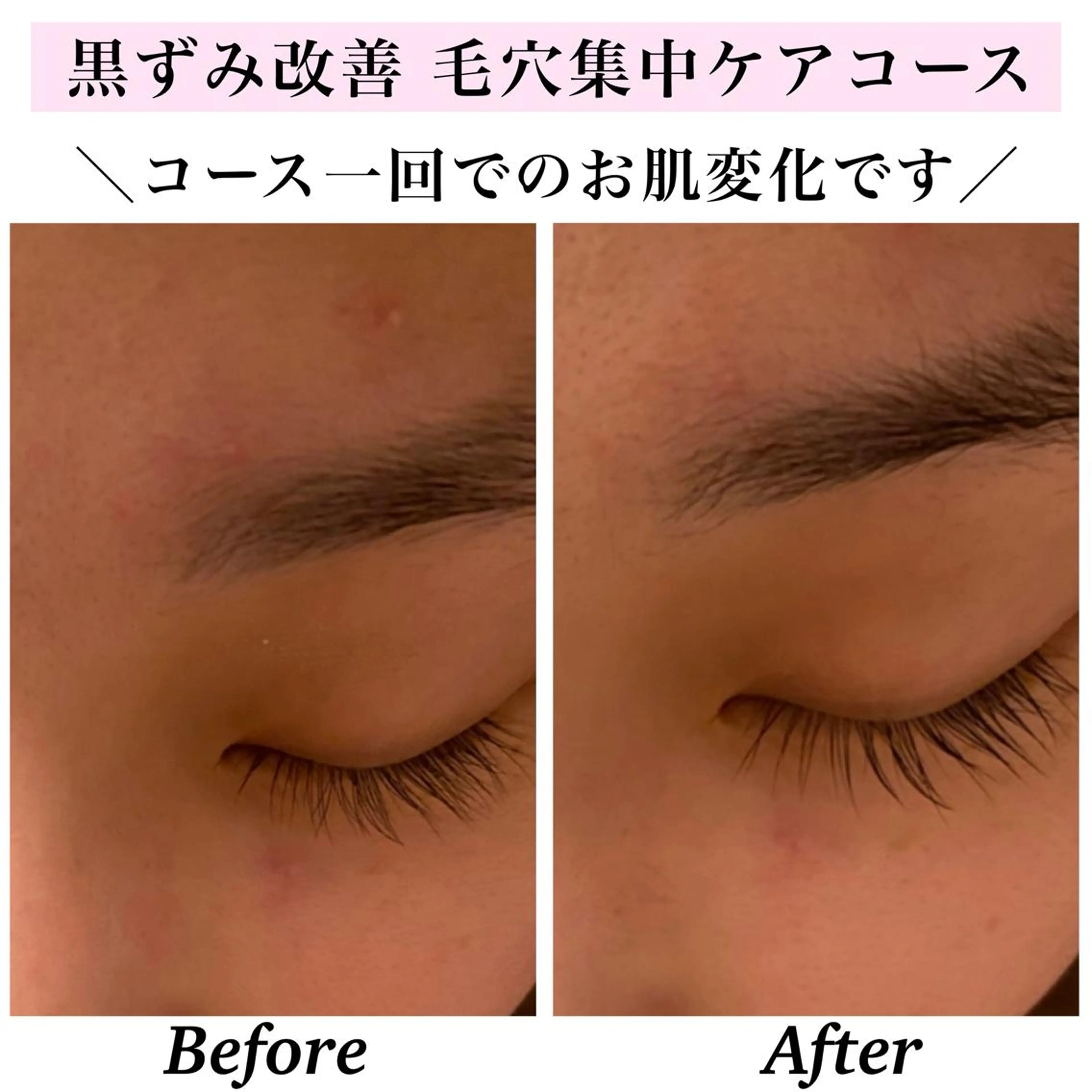 エステ リラク Bellesthe （ベルエステ）のエステ・リラクイメージ